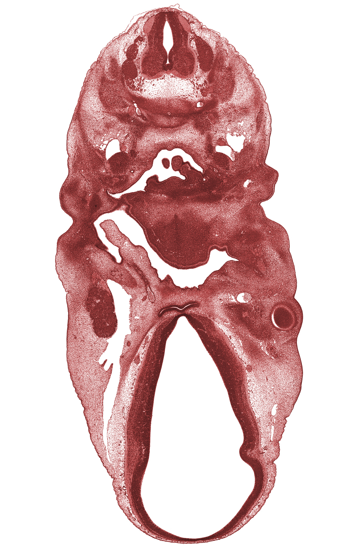 C-4 spinal nerve, C-5 spinal ganglion, adenohypophysial pouch, chorda tympani nerve, dorsal sulcus, dorsal thalamus, edge of arytenoid swelling, extra-ocular muscle mass, hypoglossal nerve (CN XII), internal carotid artery, mandibular nerve (CN V₃), marginal ridge, oropharynx, pharyngeal pouch 1, pharyngeal pouch 2, precardinal vein, primary head vein, supra-optic nucleus, vagus nerve (CN X), ventral (hypothalamic) sulcus, ventral thalamus