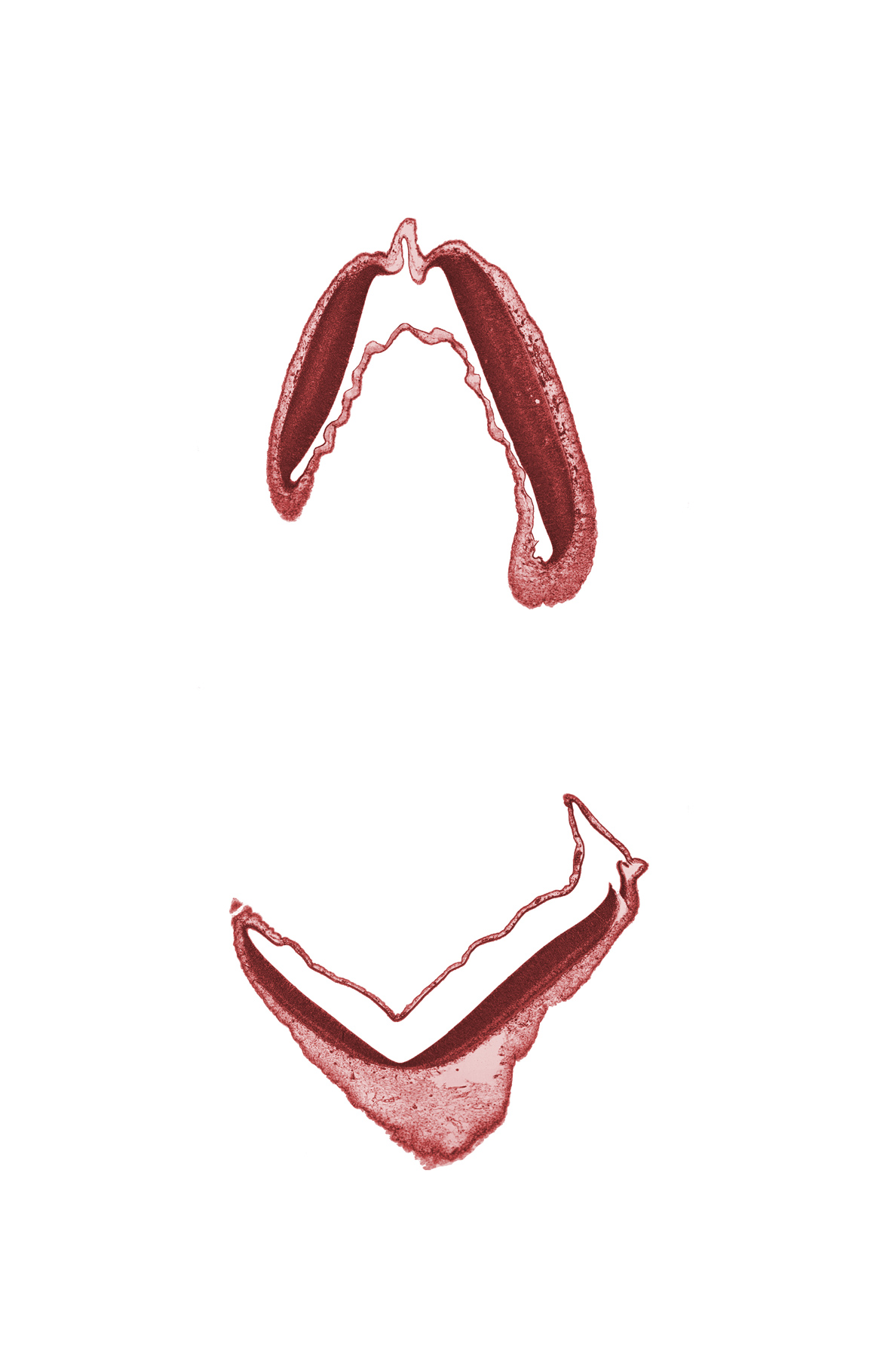 metencephalon, myelencephalon, rhombencoel (fourth ventricle)