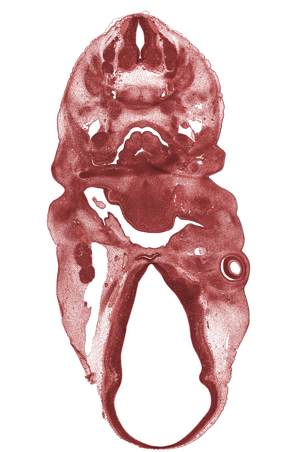 C-4 spinal nerve, C-5 spinal ganglion, adenohypophysial pouch, artifact(s), arytenoid swelling, dorsal sulcus, edge of optic stalk (CN II), intraretinal space (optic vesicle cavity), laryngeal pharynx, marginal ridge, maxillary vein, middle sulcus, optic cup cavity, pharyngeal groove 1, pharyngeal pouch 2, precartilage condensation of pharyngeal arch 1 (Meckel), retropharyngeal space, spinal accessory nerve (CN XI), third ventricle, vagus nerve (CN X), ventral (hypothalamic) sulcus, vertebral artery