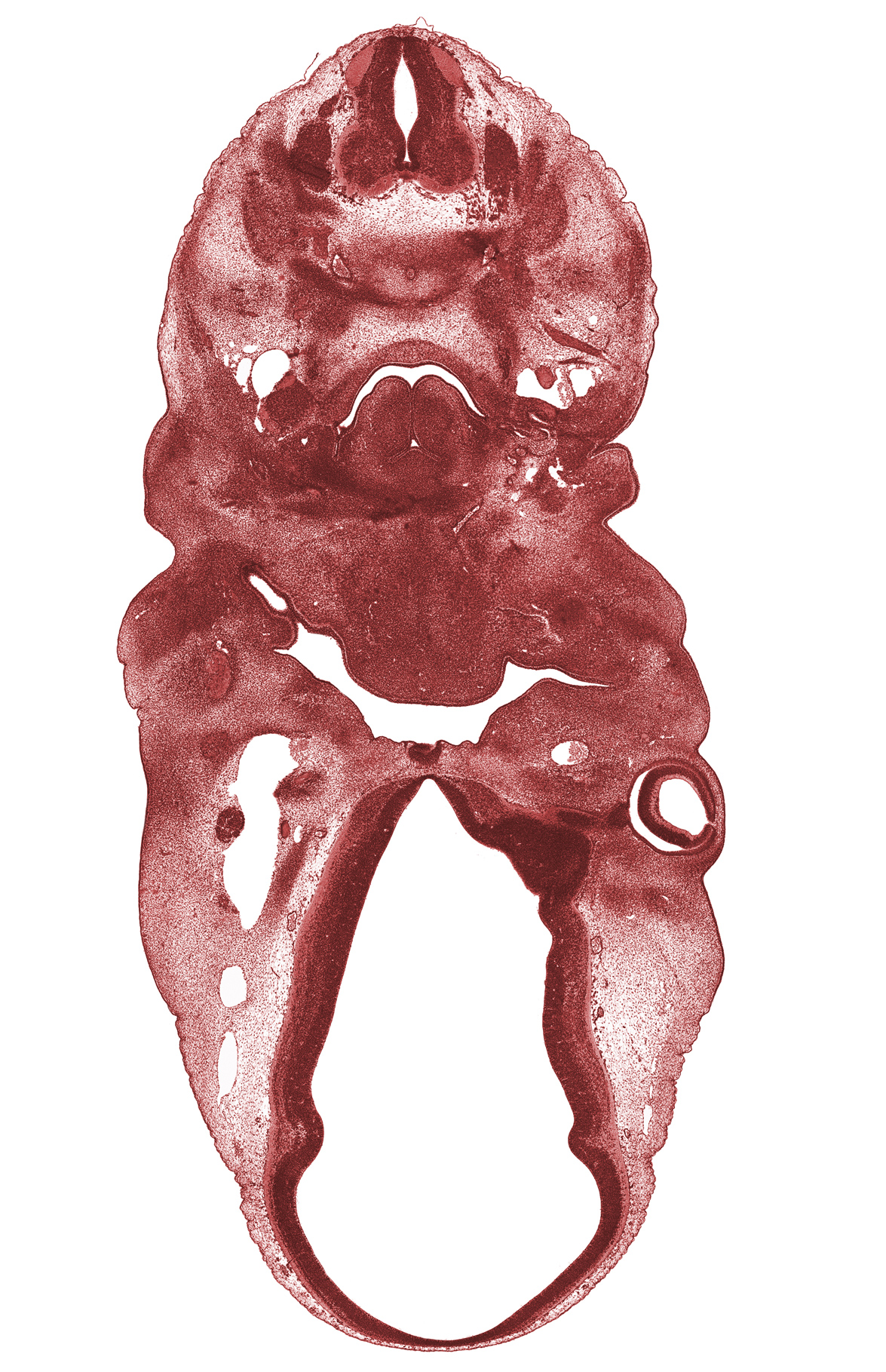 C-5 spinal ganglion, anterior dural venous plexus, auricular hillock, epimere, head mesenchyme, internal carotid artery, laryngeal pharynx, nasopharynx, neural arch, opening of adenohypophysial pouch, primary head vein, spinal accessory nerve (CN XI), sternocleidomastoid muscle, surface ectoderm, thyroglossal duct, trapezius muscle, vascular plexus