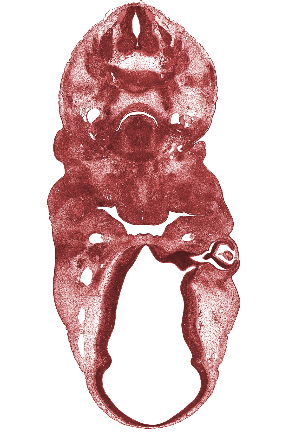 C-5 spinal ganglion, C-5 spinal nerve, C-6 spinal ganglion, auricular hillock, extrinsic tongue muscle(s), foramen cecum of tongue, head mesenchyme, hypoglossal nerve (CN XII), internal carotid artery, intraretinal space (optic vesicle cavity), lens, marginal ridge, meninx, optic cup cavity, optic stalk (CN II), optic stalk lumen (CN II), precartilage condensation of hyoid bone, sternocleidomastoid / trapezius muscle, vascular plexus