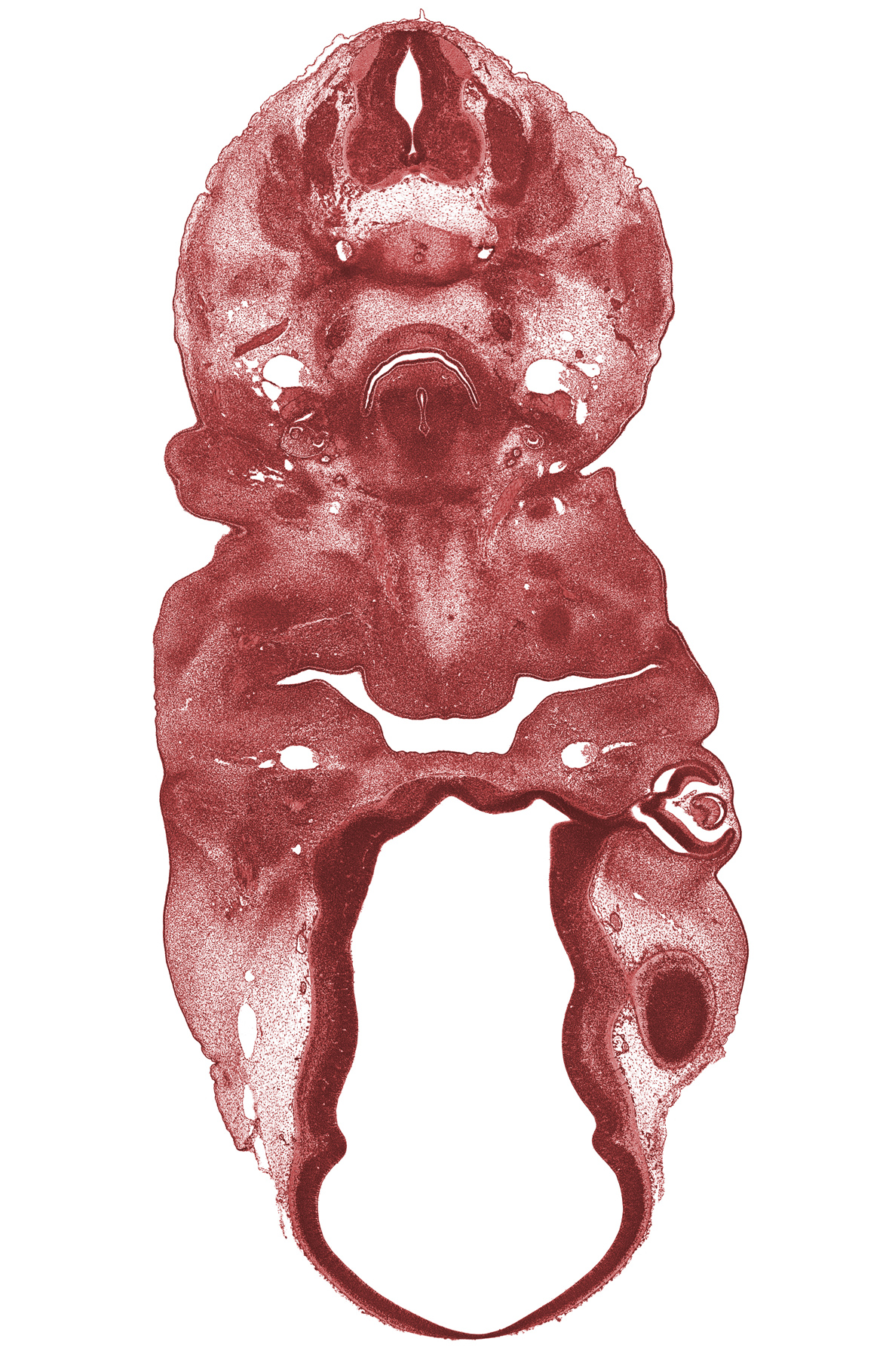 C-5 spinal nerve, C-6 spinal ganglion, central canal, corneal epithelium, epithelial lamina of larynx, hypoglossal nerve (CN XII), internal layer of retina, laryngeal condensation, mandibular prominence of pharyngeal arch 1, maxillary prominence of pharyngeal arch 1, meninx, missing tissue (artifact), oral cavity, oronasal cavity, precardinal vein, primary lens fiber, tongue