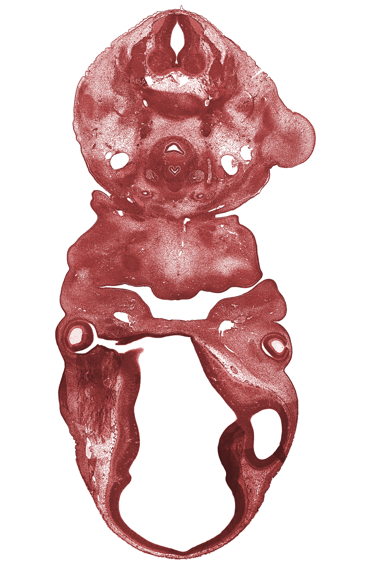 C-6 spinal ganglion, anterior cerebral artery, auricular hillock, brachial plexus, cerebral vesicle (telencephalon), dorsal thalamus, jugular lymph sac, left common carotid artery, mandibular prominence of pharyngeal arch 1, maxillary prominence of pharyngeal arch 1, maxillary vein, oronasal cavity, primordial oral vestibule, right common carotid artery, sternocleidomastoid muscle, sympathetic trunk, thymus gland, trapezius muscle, ventral thalamus