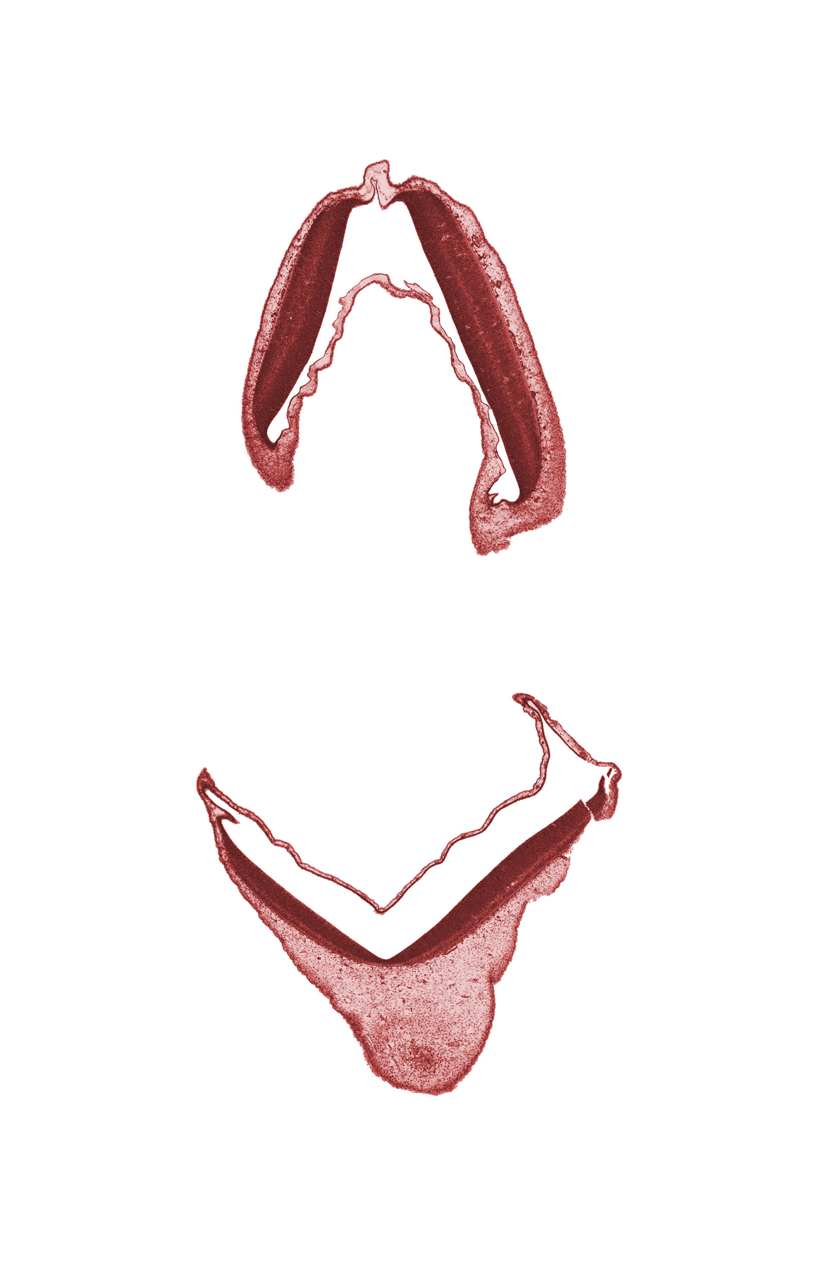 alar plate of metencephalon, alar plate of myelencephalon, edge of mesencephalon, head mesenchyme, roof plate