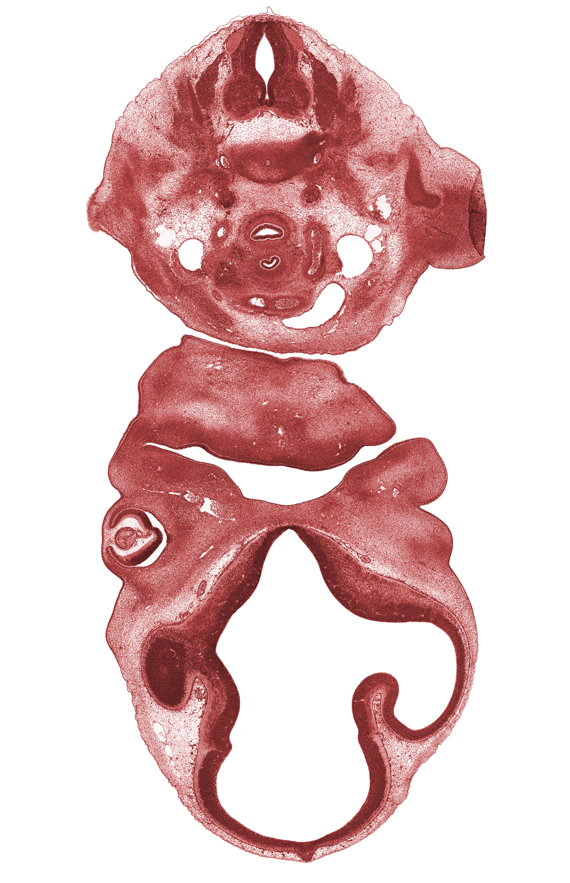 C-7 spinal ganglion, aortic arch 6 (ductus arteriosus), corneal epithelium, corpus striatum, edge of shoulder, intermediate zone, intraretinal space (optic vesicle cavity), left horn of aortic sac (arch of aorta), lens, marginal zone, maxillary venous plexus, optic cup cavity, pericardial cavity, pigmented layer of retina, pineal bud, right horn of aortic sac (brachiocephalic trunk), scapula cartilage, tissue fold (artifact), torus hemisphericus, ventricular zone