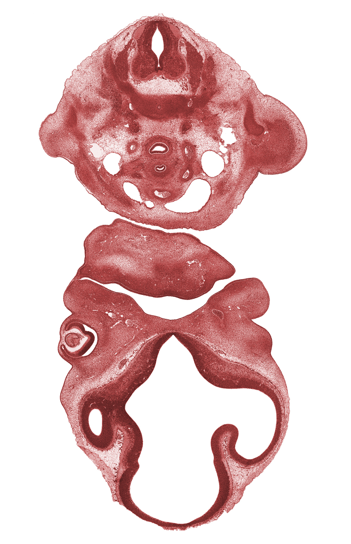 C-7 spinal ganglion, anterior cerebral artery, aortic sac, brachial plexus, diencephalon, dorsal aorta, dorsal fasciculus, esophagus, mandibular prominence of pharyngeal arch 1, maxillary prominence of pharyngeal arch 1, missing tissue (artifact), notochord, oronasal cavity, precardinal vein, pulmonary trunk, telencephalon, trachea