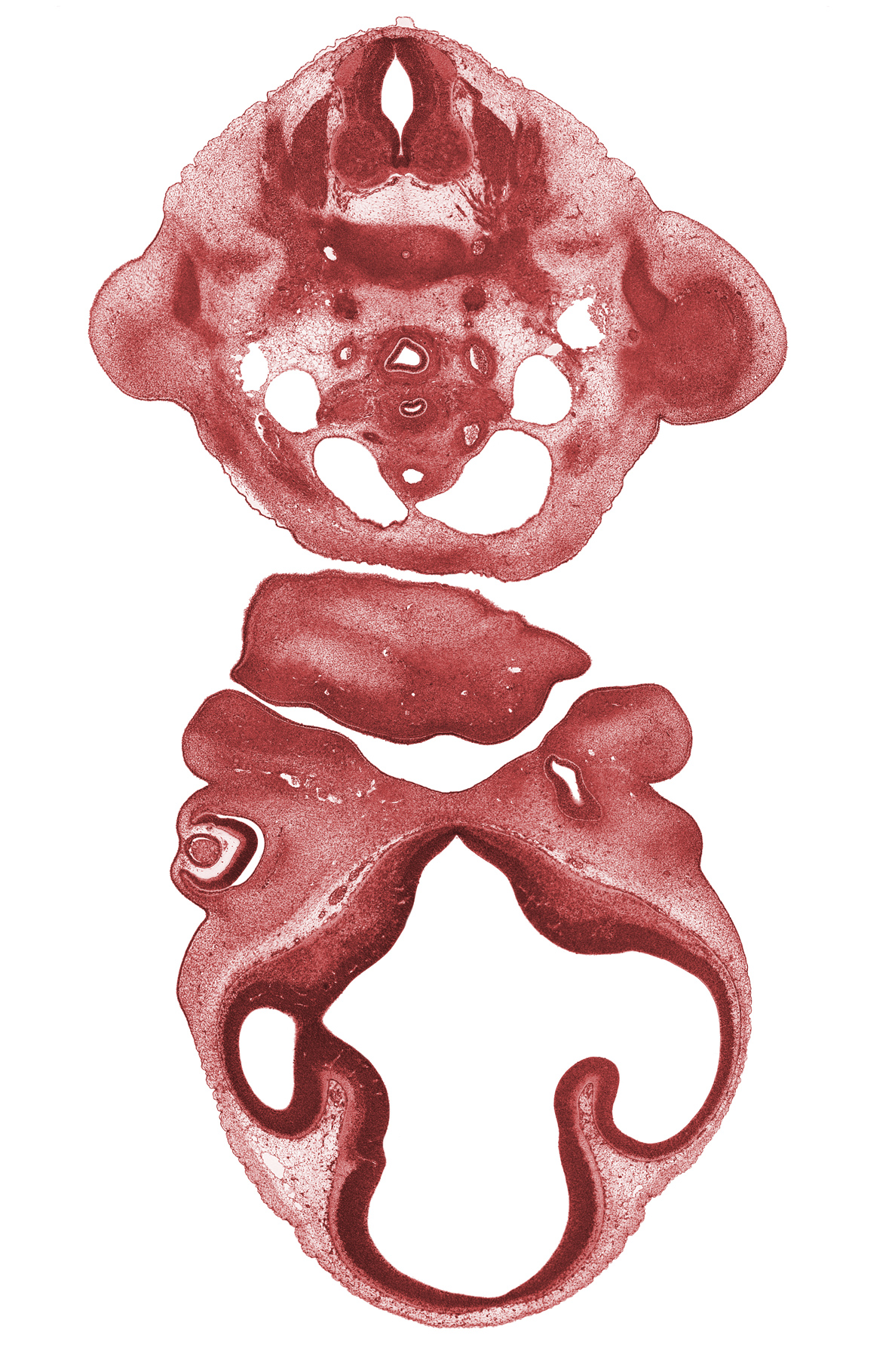 C-7 spinal ganglion, C-7 spinal nerve, ascending aorta, dorsal aorta, edge of nasal sac, interventricular foramen, lateral ventricle, mandibular prominence of pharyngeal arch 1, marginal zone of retina, maxillary prominence of pharyngeal arch 1, maxillary venous plexus, oral fissure, oronasal cavity, precardinal vein, pulmonary trunk, sympathetic trunk, third ventricle, vagus nerve (CN X)