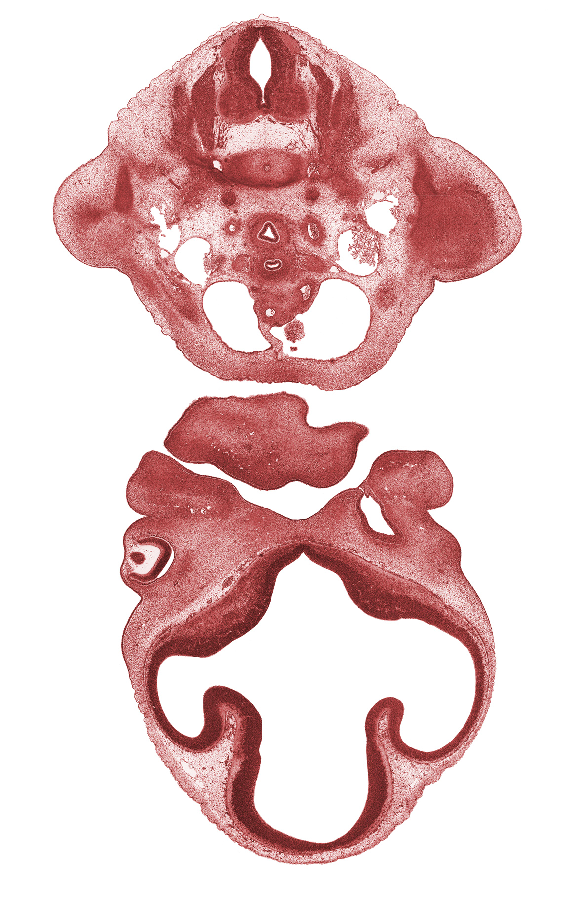 C-7 spinal nerve, C-8 spinal ganglion, ascending aorta, commissural plate, corneal epithelium, dorsal aorta, edge of left atrium, heart prominence, intraretinal space (optic vesicle cavity), lateral ventricle, lens, median mandibular groove, nasal capsule, nasal fin, optic cup cavity, pericardial cavity, pulmonary trunk, third ventricle, torus hemisphericus, vagus nerve (CN X), vascular plexus