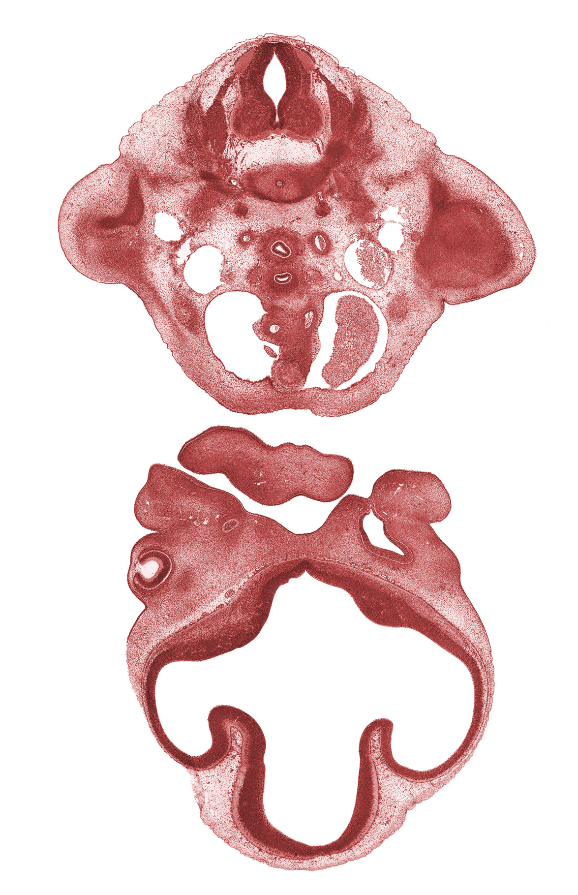C-8 spinal ganglion, ascending aorta, central canal, dorsal aorta, esophageal condensation, interventricular foramen, junction of maxillary and medial nasal prominences, lateral ventricle, left atrium, nasal disc (olfactory placode), optic cup cavity, pulmonary trunk, shoulder region, sympathetic trunk, torus hemisphericus, tracheal condensation