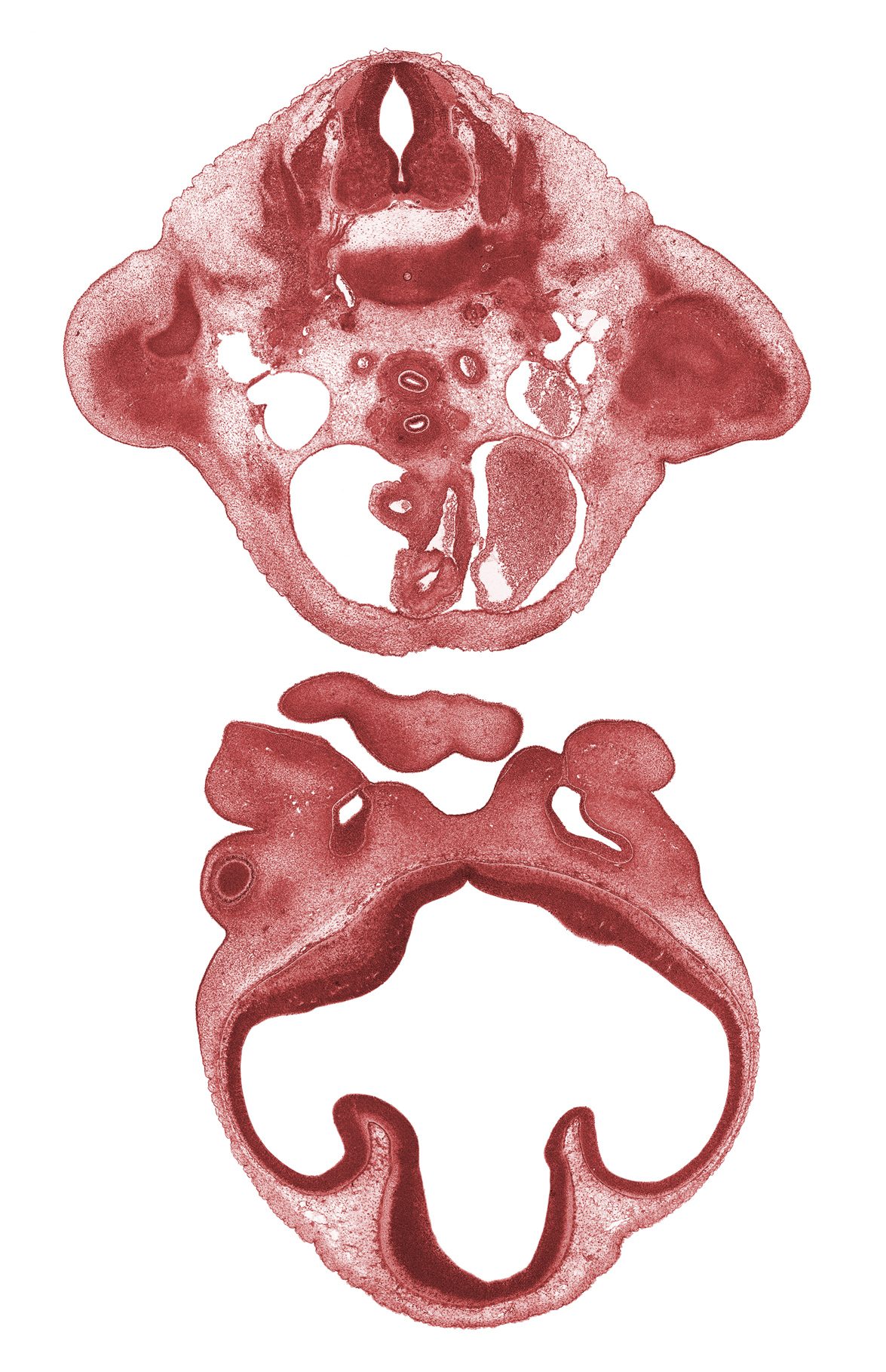 C-8 spinal ganglion, ascending aorta, brachial plexus, dorsal aorta, esophagus endoderm, left atrium, lumen of nasal sac, maxillary prominence of pharyngeal arch 1, medial nasal prominence(s), nasal disc (olfactory placode), nasal septum, pericardial cavity, phrenic nerve, precardinal vein, pulmonary semilunar valve, pulmonary trunk, roof of diencephalon, striatal part of cerebral vesicle (telencephalon), suprastriatal part of cerebral vesicle (telencephalon), torus hemisphericus, trachea (endoderm)