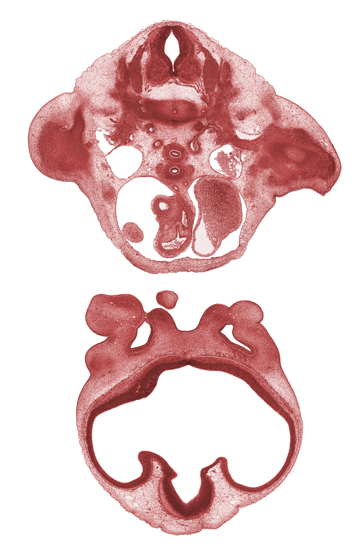 C-8 spinal ganglion, C-8 spinal nerve, alar plate(s), ascending aorta, basal plate, corpus striatum, dorsal intersegmental artery, edge of mandibular prominence of pharyngeal arch 1, edge of right atrium, floor plate, humerus cartilage, lumen of nasal sac, maxillary prominence of pharyngeal arch 1, medial nasal prominence(s), meninx, nasal fin, olfactory filia (CN I), precardinal vein, pulmonary semilunar valve, roof plate, sulcus limitans