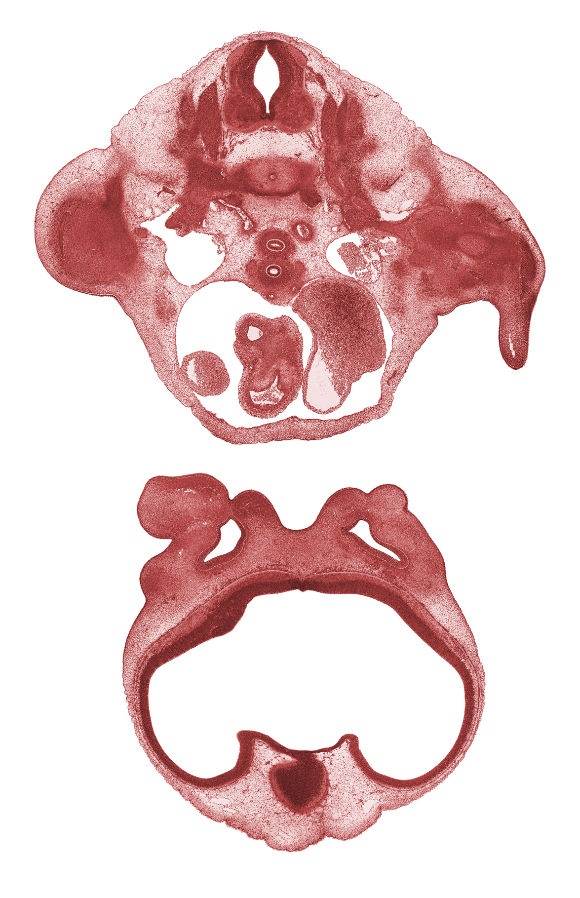 C-8 spinal ganglion, C-8 spinal nerve, aorticopulmonary septum, ascending aorta, dorsal intersegmental artery, edge of diencephalon, heart prominence, humerus cartilage, infundibulum of right ventricle, left atrium, left pulmonary artery, maxillary prominence of pharyngeal arch 1, neural arch, presumptive olfactory bulb, right atrium, right pulmonary artery, striatal part of cerebral vesicle (telencephalon), subclavian vein, suprastriatal part of cerebral vesicle (telencephalon), transverse sinus