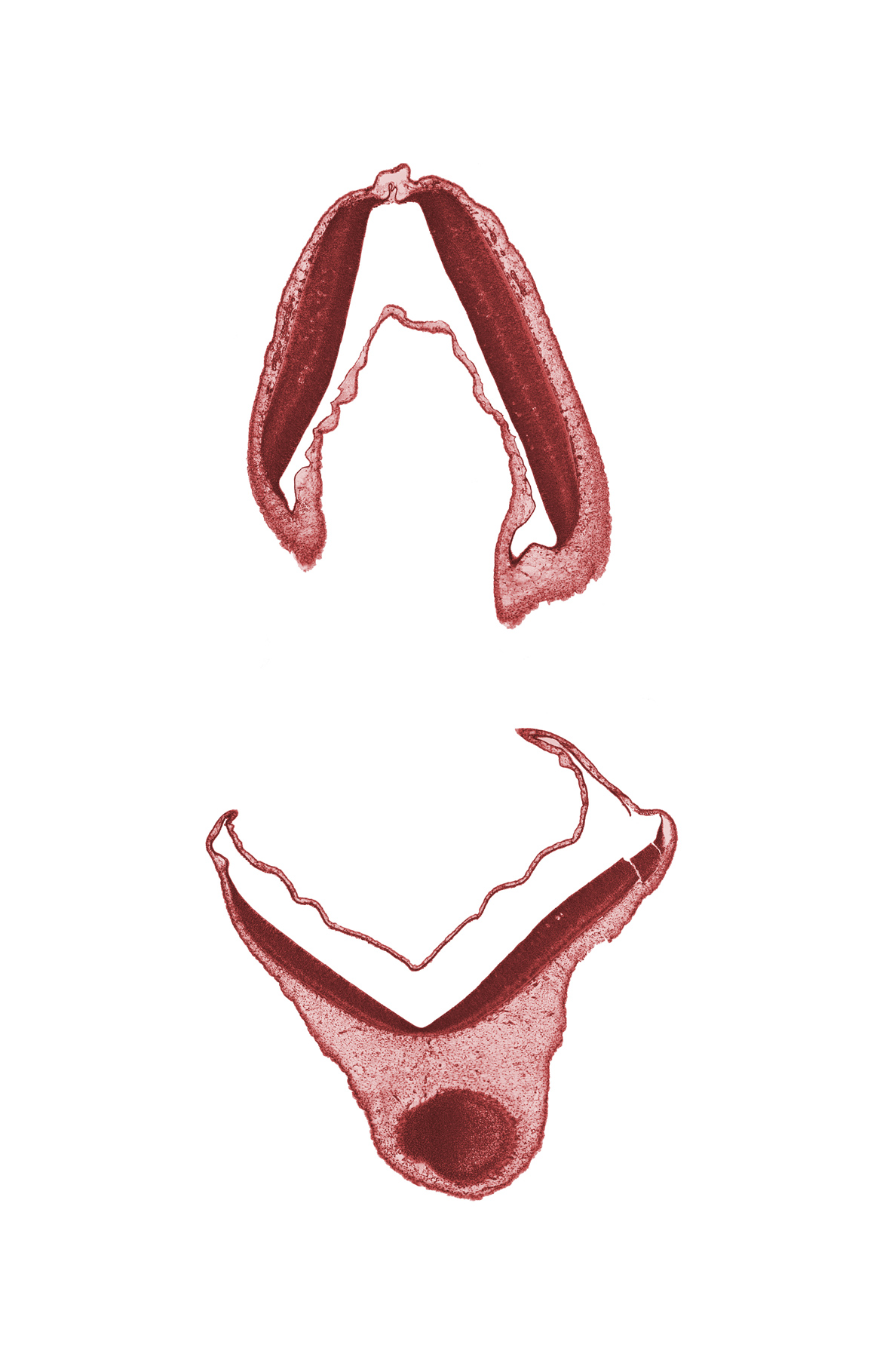 mesencephalon (M2), tissue fracture (artifact), vascular plexus