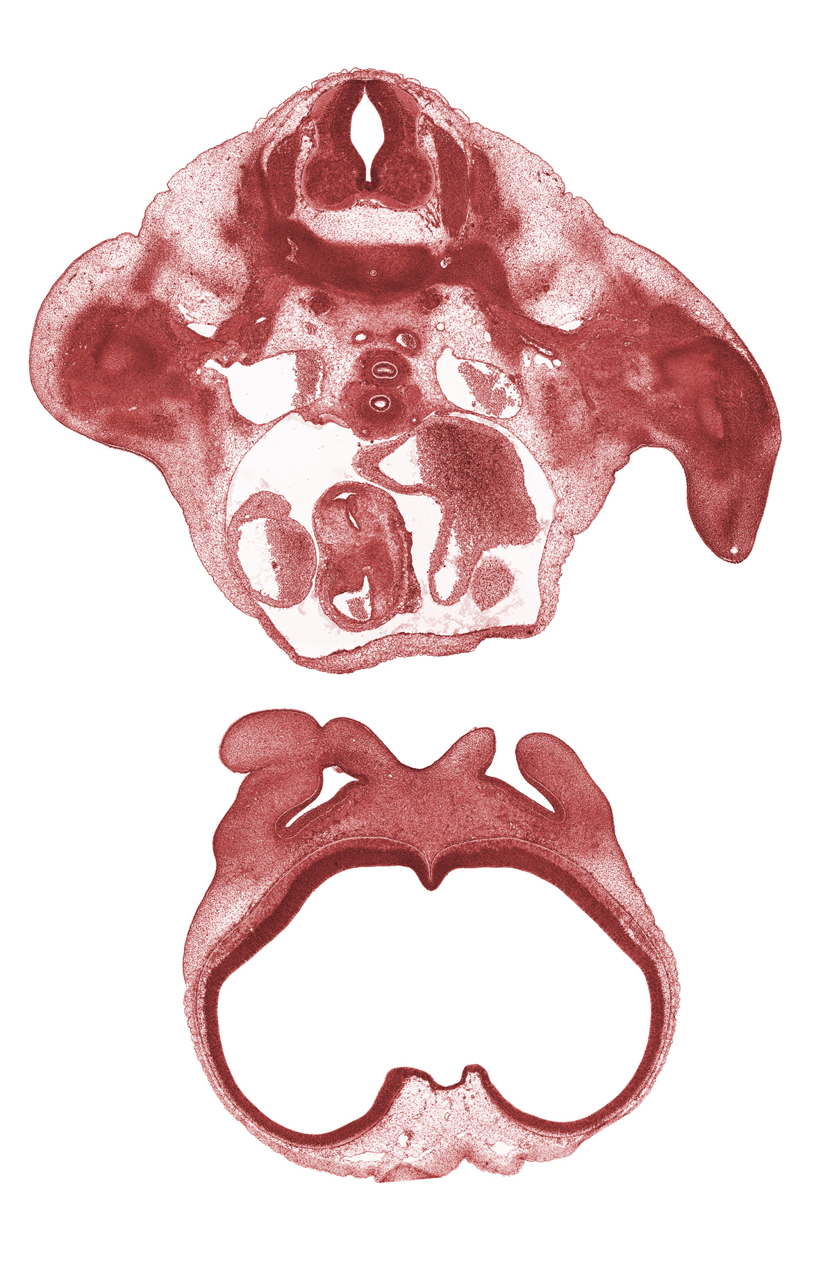 T-1 spinal ganglion, aortic semilunar valve, aorticopulmonary septum, archipallium, cerebral vesicle (neopallium), cornu Ammonis, edge of left ventricle, esophagus endoderm, gyrus dentatus, infundibulum of right ventricle, left atrium, left precardinal vein, left vagus nerve (CN X), nasal capsule, nasomaxillary groove, paleopallium, right atrium, right precardinal vein, subclavian artery, subclavian vein, sympathetic trunk, telencephalon, trachea (endoderm)