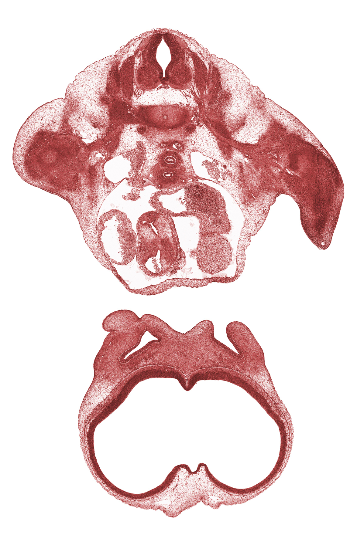 T-1 spinal ganglion, T-1 spinal nerve, aortic semilunar valve, brachial plexus, cornu Ammonis, gyrus dentatus, infundibulum of right ventricle, junction of dorsal aortas, lateral nasal prominence, lateral ventricle, left atrium, left ventricle, maxillary prominence of pharyngeal arch 1, medial nasal prominence(s), naris, right precardinal vein, subclavian artery, telencephalon medium