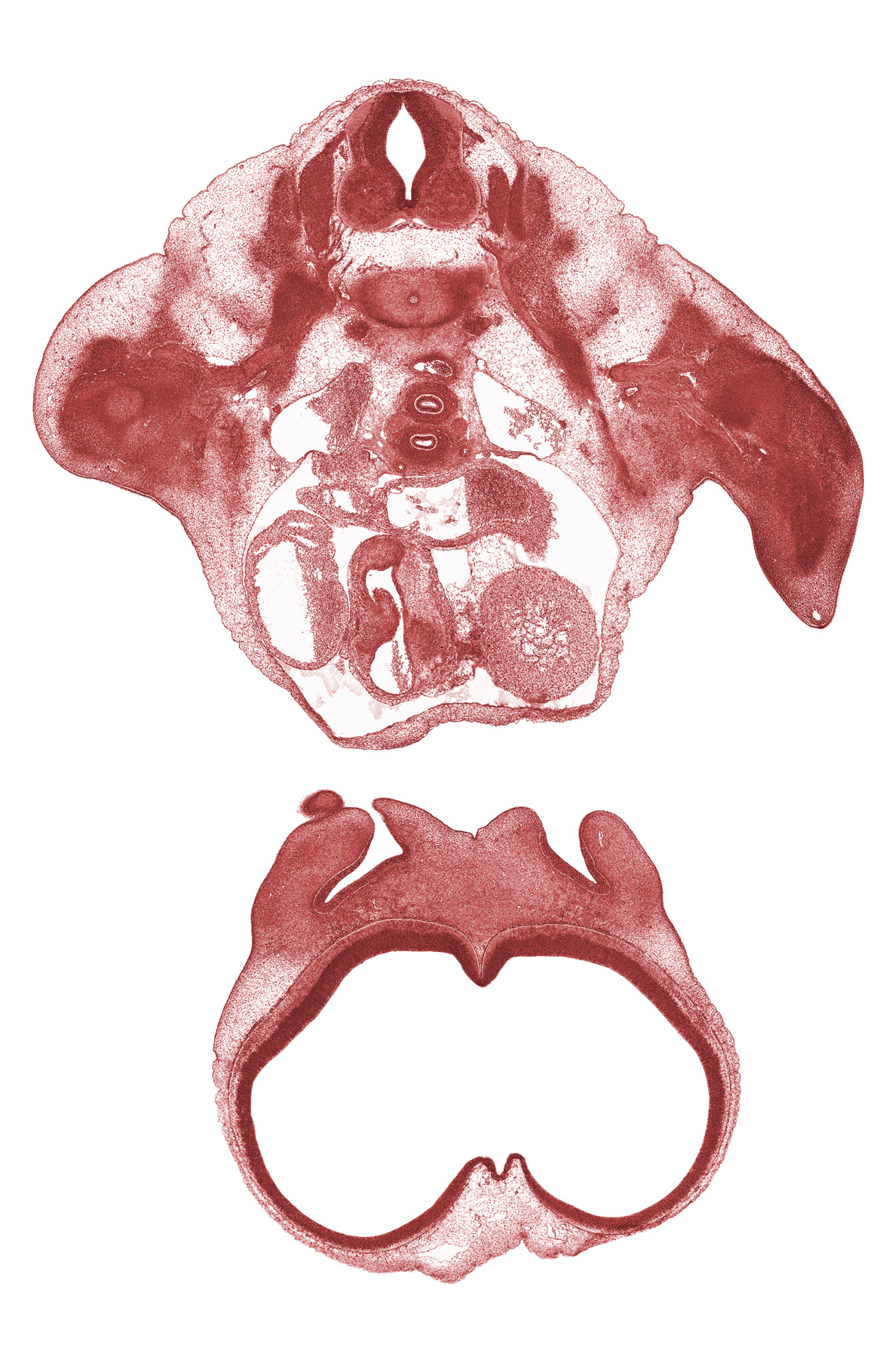 T-1 spinal ganglion, aorta, cerebral vesicle (telencephalon), edge of maxillary prominence of pharyngeal arch 1, head mesenchyme, left ventricle, naris, nasal capsule, nasal disc (olfactory placode), olfactory filia (CN I), phrenic nerve, rib 1, right atrium, right pulmonary artery, secondary interatrial foramen (foramen secundum), subclavian artery, surface ectoderm, telencephalon medium, tracheal bifurcation, tuberculum olfactorium, undivided truncus arteriosus