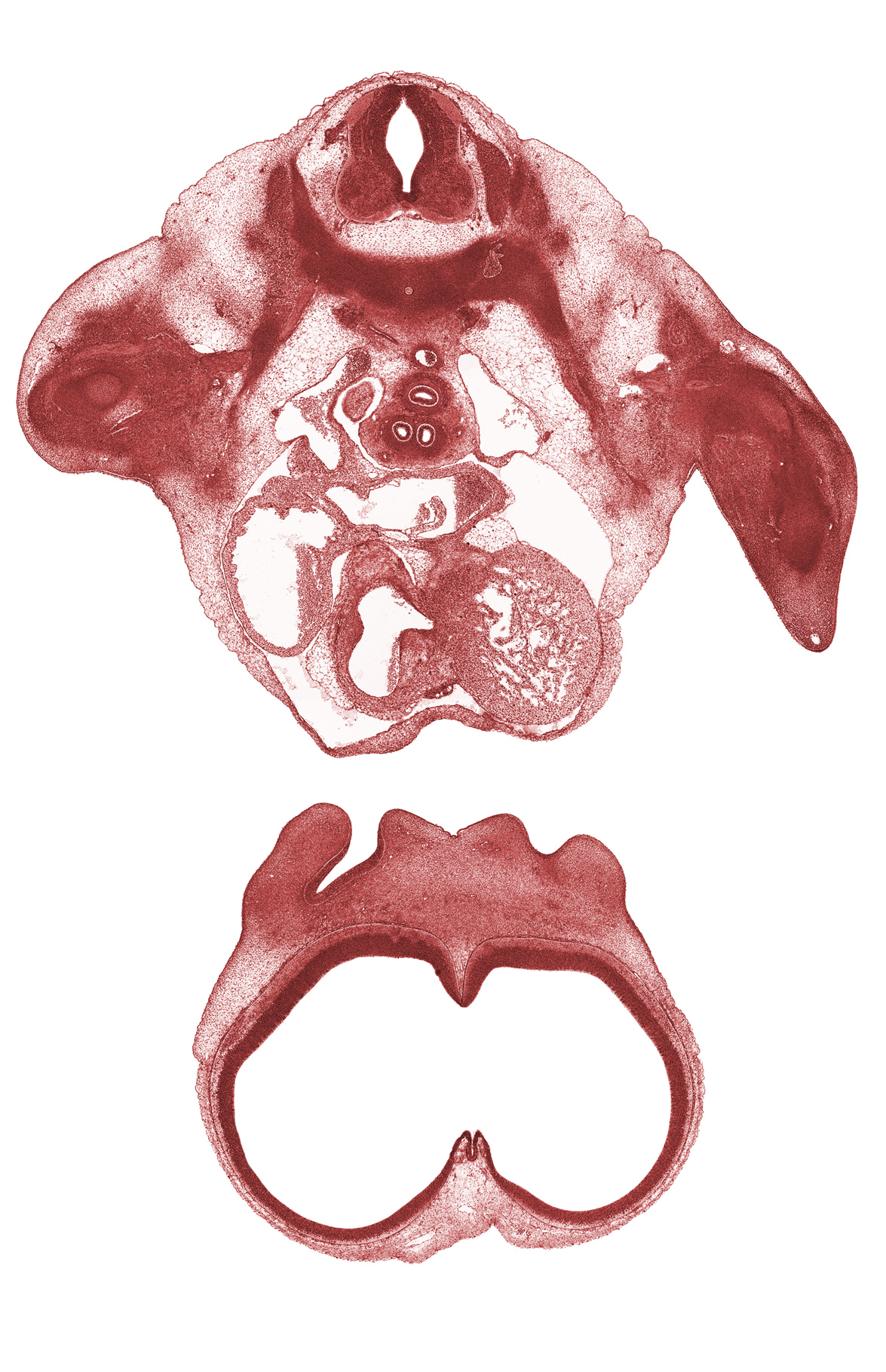 T-2 spinal ganglion, aortic vestibule of left ventricle, apex of right lung sac, edge of pleural cavity, infundibulum of right ventricle, interventricular foramen, lateral nasal prominence, lateral ventricle, left primary bronchus, left ventricle, medial nasal prominence(s), rib 1, right atrium, secondary interatrial foramen (foramen secundum), secondary interatrial septum (septum secundum), sinus venosus, subclavian artery, third ventricle