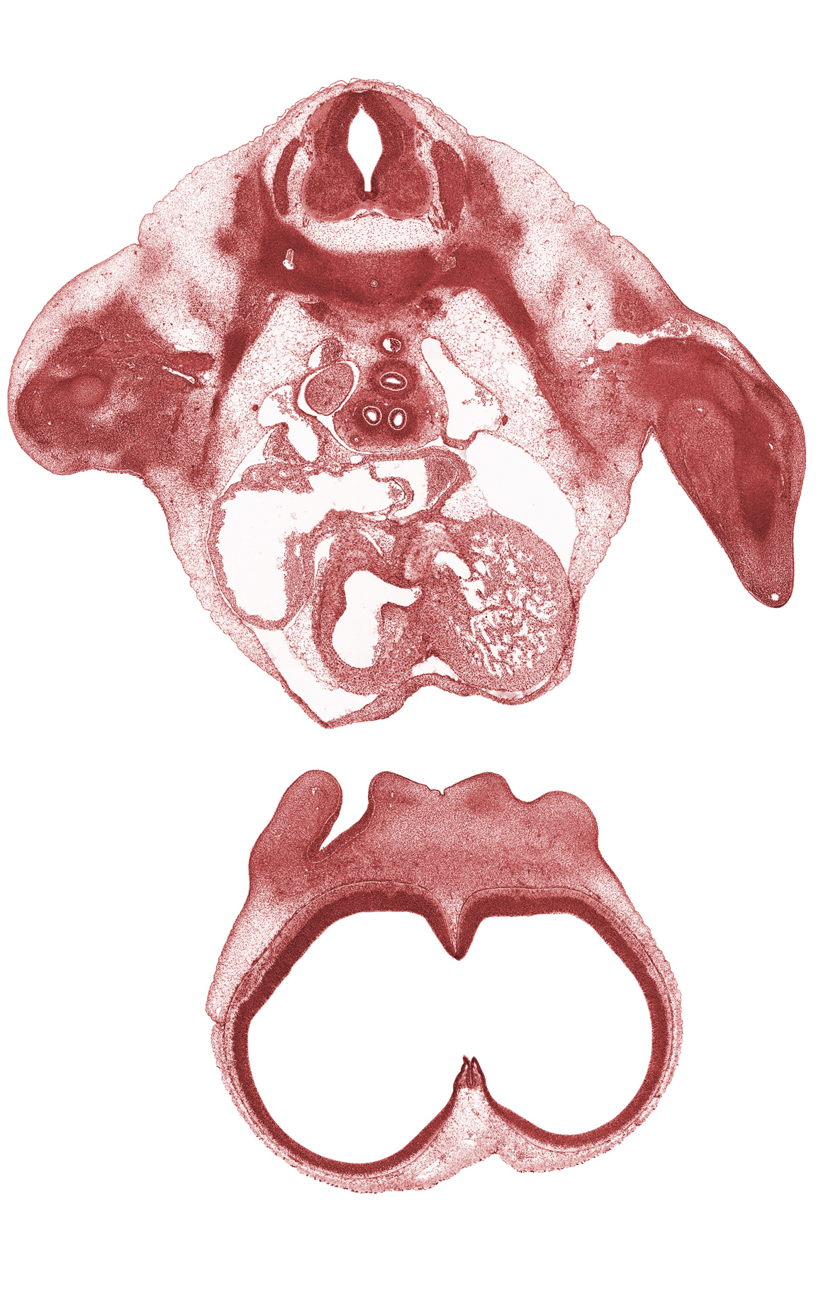 T-2 spinal ganglion, aorticopulmonary ridges, cerebral vesicle (telencephalon), head mesenchyme, junction of lateral and medial nasal prominences, left atrium, left common cardinal vein, left ventricle, pericardial cavity, phrenic nerve, primary interatrial septum (septum primum), rib 2, right atrium, right postcardinal vein, right pulmonary artery, sinus venosus, undivided truncus arteriosus (proximal outflow tract)