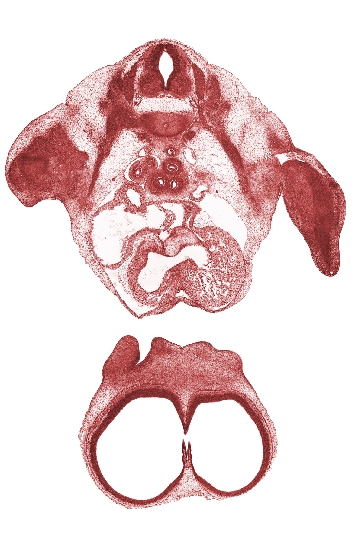 T-2 spinal ganglion, T-2 spinal nerve, aorta, atrioventricular endocardial cushion(s), atrioventricular sulcus, caudal edge of interventricular foramen, edge of interventricular foramen, interventricular foramen, interventricular sulcus, lateral nasal prominence, left horn of sinus venosus, left postcardinal vein, naris, phrenic nerve, primary interatrial septum (septum primum), right atrium, right postcardinal vein, sinus venosus