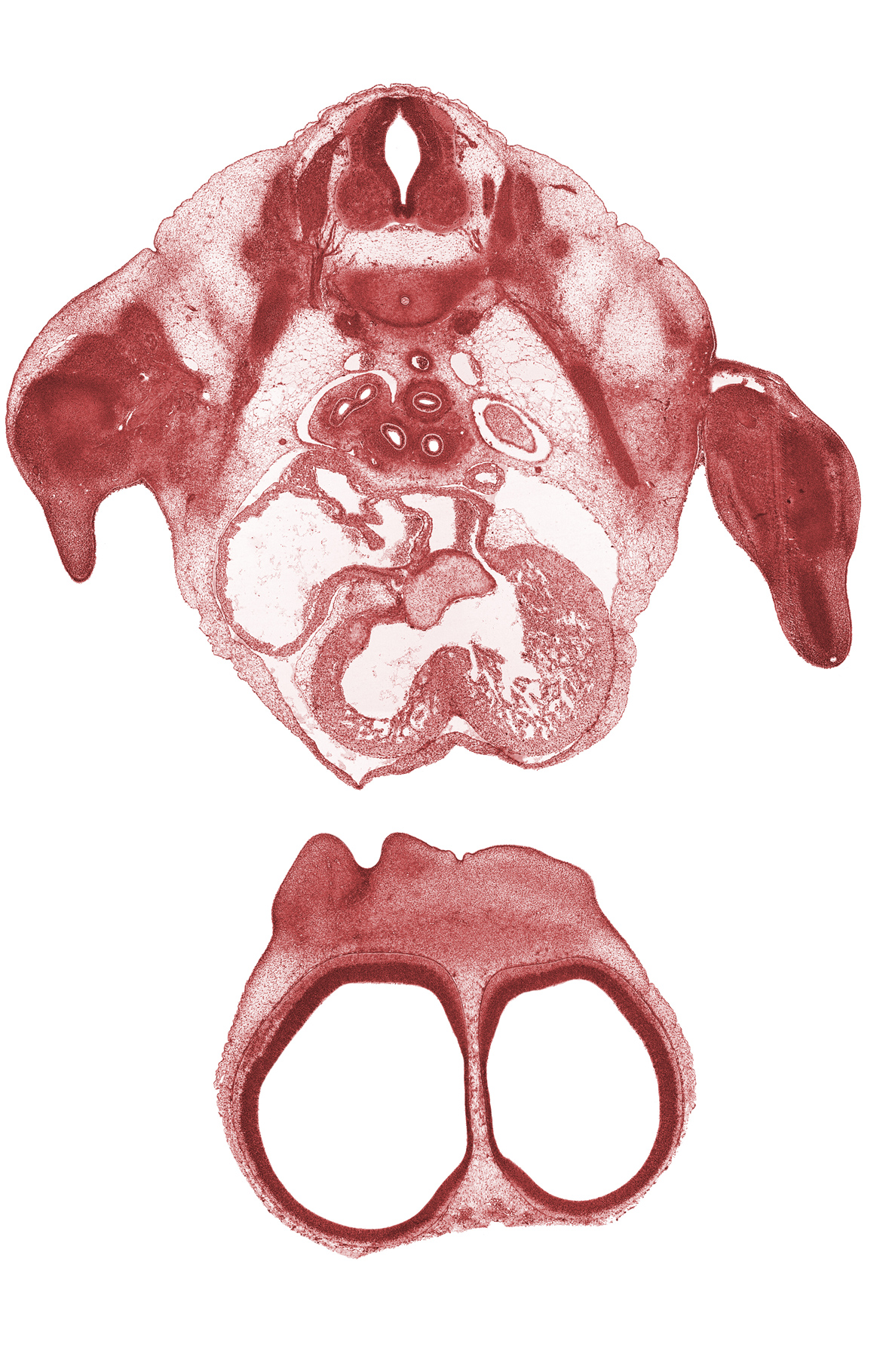 T-2 / T-3 interganglion region, aorta, apex of left lung sac, elbow region, forearm region, hand, interorbital ligament, interventricular foramen, lateral ventricle, left atrium, primary interatrial septum (septum primum), right atrium, right primary bronchus, sinus venosus, tertiary bronchopulmonary buds in upper lobe of right lung