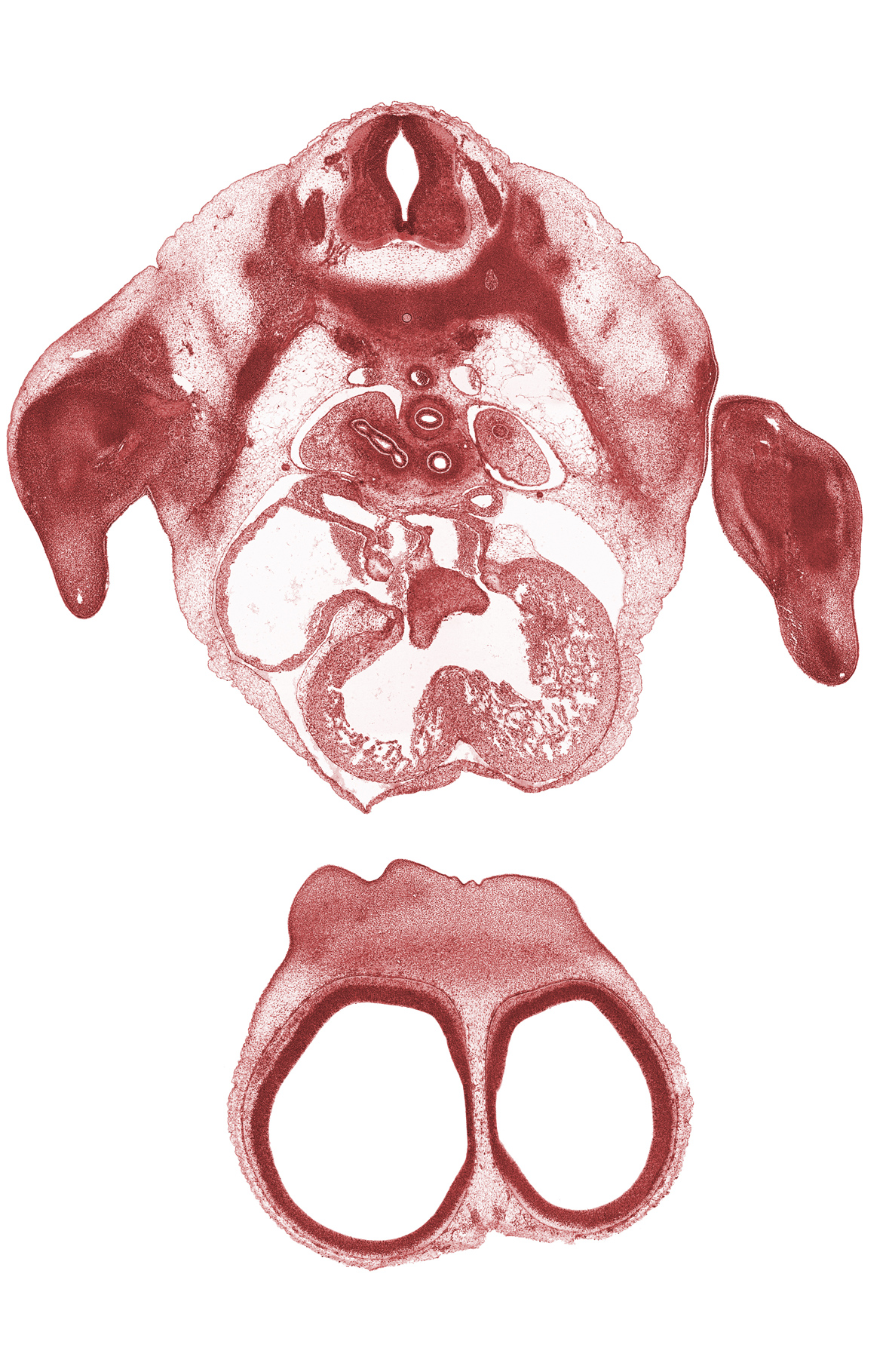 T-3 spinal ganglion, aorta, atrioventricular endocardial cushion(s), edge of naris, frontal prominence, interorbital ligament, junction of lateral and medial nasal prominences, left atrioventricular canal, left atrium, left horn of sinus venosus, left primary bronchus, pleural cavity, pleuropericardial membrane, primary interatrial septum (septum primum), right atrioventricular canal, sinus venosus, sympathetic trunk, upper secondary bronchus