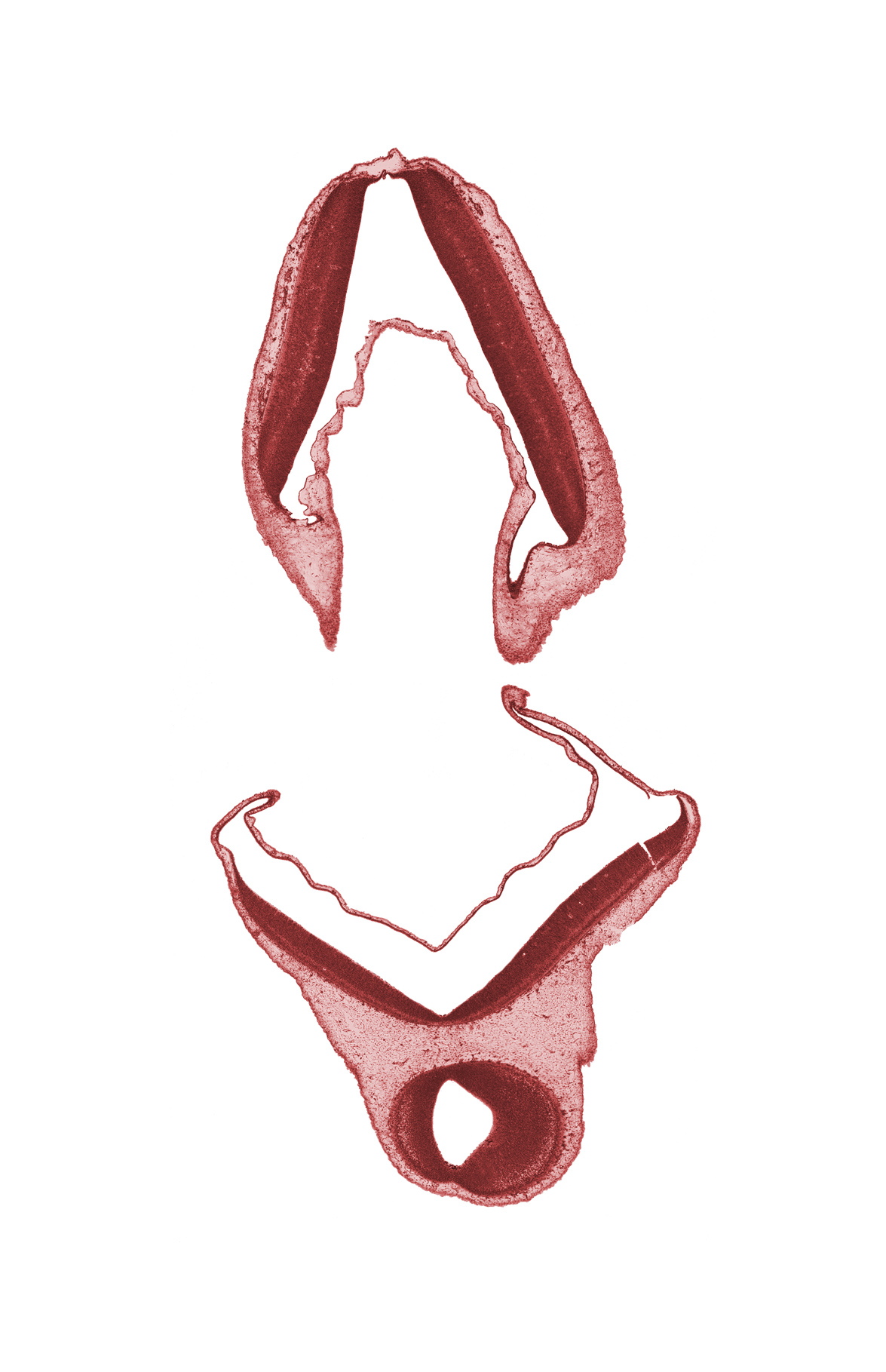 edge of mesencoel (cerebral aqueduct), metencephalon, myelencephalon, rhombencoel (fourth ventricle), roof plate of rhombencephalon