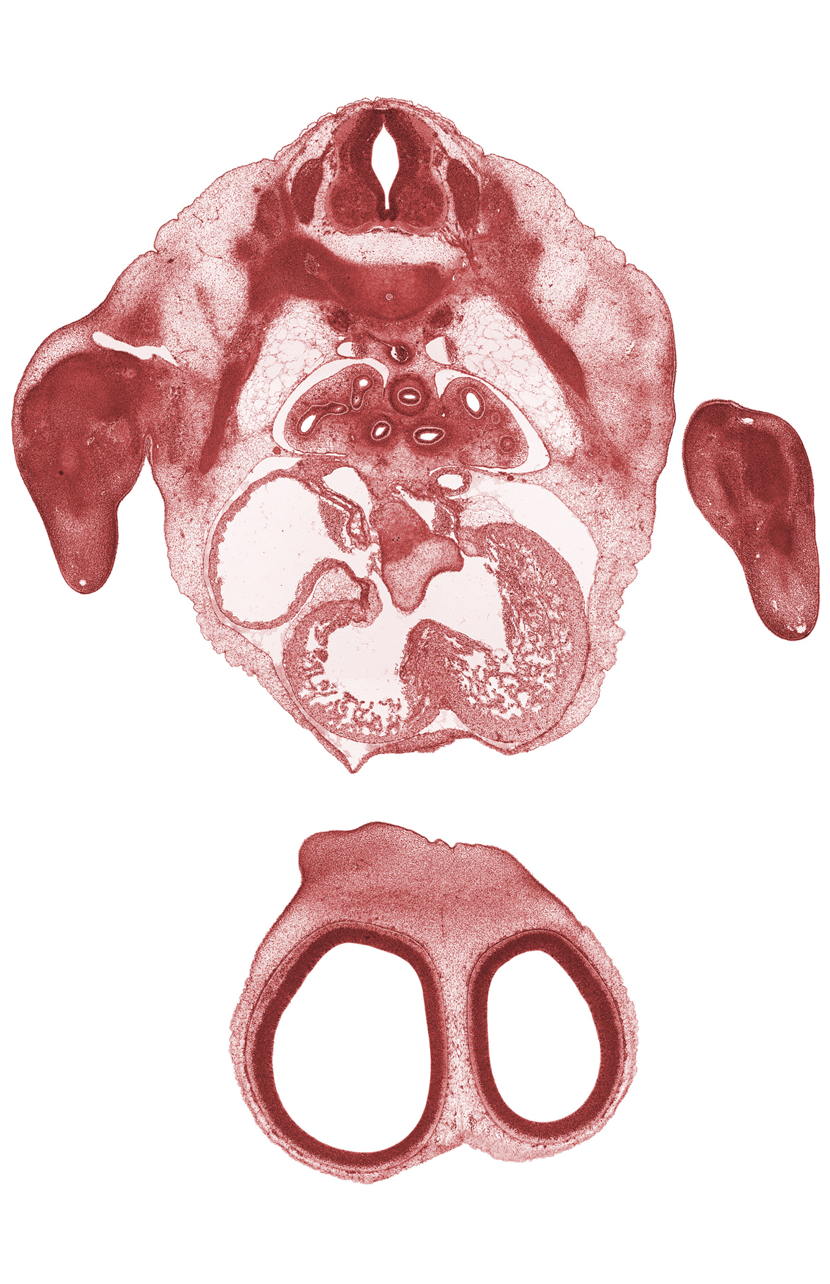 T-3 spinal ganglion, T-3 ventral root, aorta, epimere, esophagus endoderm, frontal prominence, hand plate, interorbital ligament, left atrium, left horn of sinus venosus, meninx, muscular part of interventricular septum, phrenic nerve, postcardinal vein, right atrium, sinus venosus, trabecular part of left ventricle, trabecular part of right ventricle