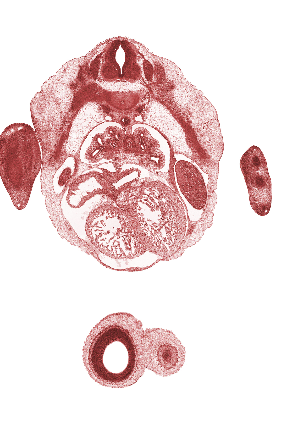 T-4 spinal ganglion, T-4 spinal nerve, edge of cerebral vesicle(s), edge of liver, hand rays (metacarpal precartilages), heart prominence, lateral ventricle, muscular interventricular septum, musculi pectinati in right atrial wall, postcardinal vein, sympathetic trunk, tertiary bronchopulmonary buds in lower lobe of left lung, tertiary bronchopulmonary buds in middle lobe of right lung