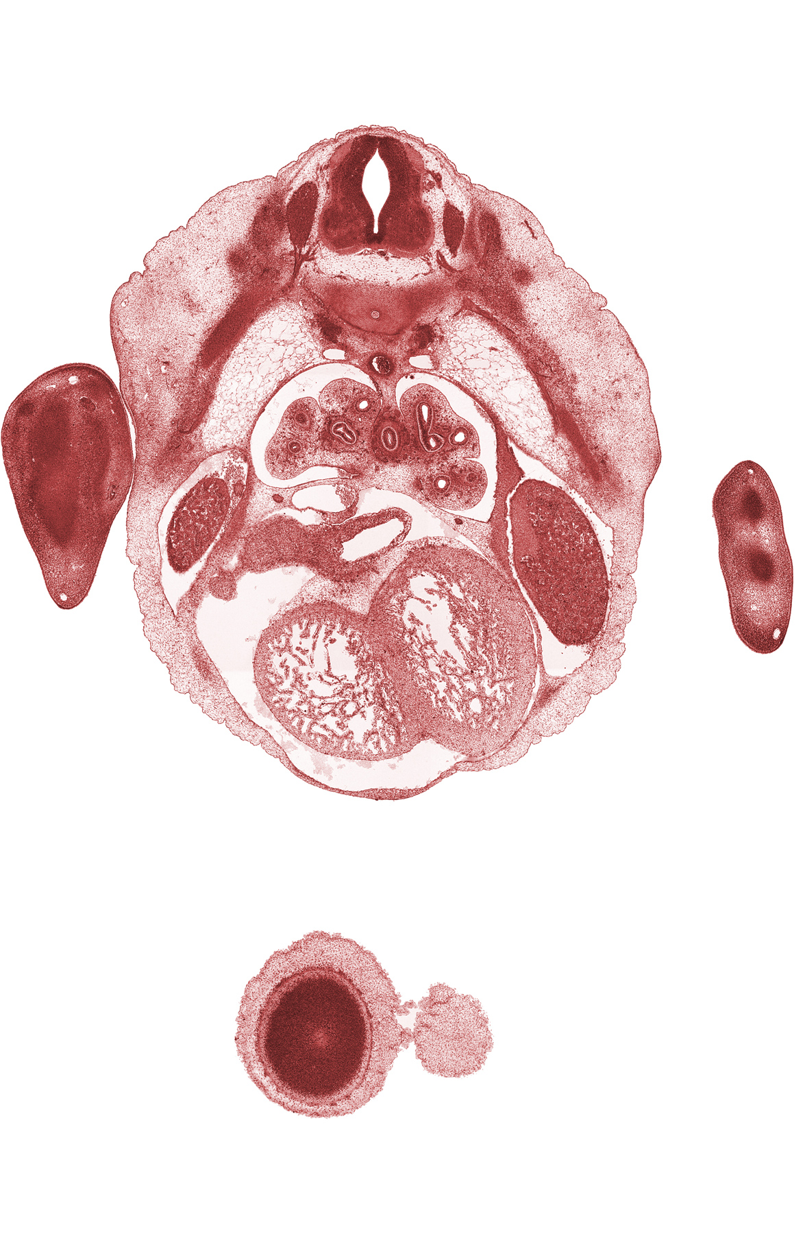 T-4 intercostal nerve, T-4 spinal ganglion, frontal prominence, inferior vena cava, left horn of sinus venosus, left ventricle, lower secondary bronchus, pericardial cavity, peritoneal cavity, pleural cavity, right ventricle