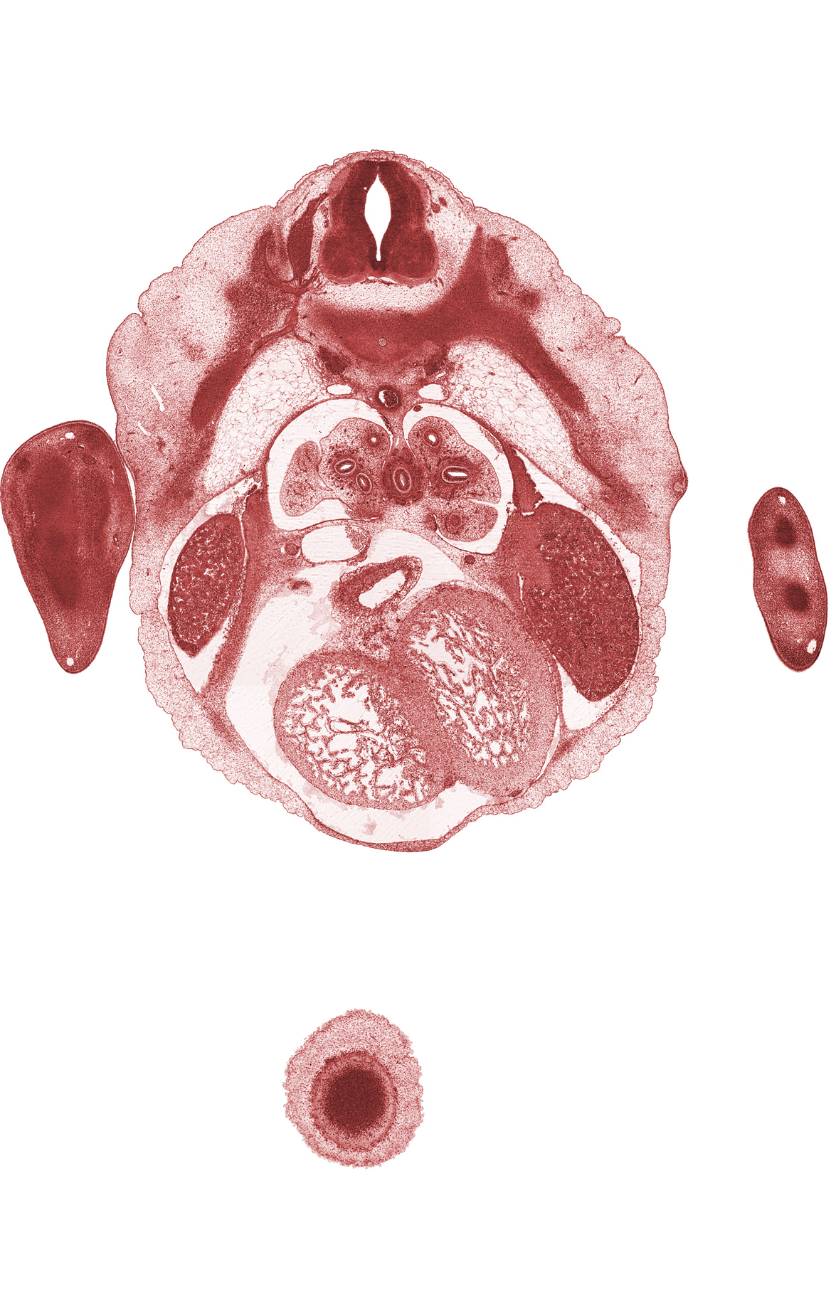 T-4 / T-5 interganglion region, aorta, central canal, communicating ramus, dorsal meso-esophagus, edge of cerebral vesicle(s), edge of frontal prominence, edge of mammary gland, esophagus endoderm, hand rays (metacarpal precartilages), heart prominence, inferior vena cava, intermediate zone, left horn of sinus venosus, left lobe of liver, marginal zone, pericardial cavity, peritoneal cavity, rib 5, right lobe of liver, sympathetic trunk