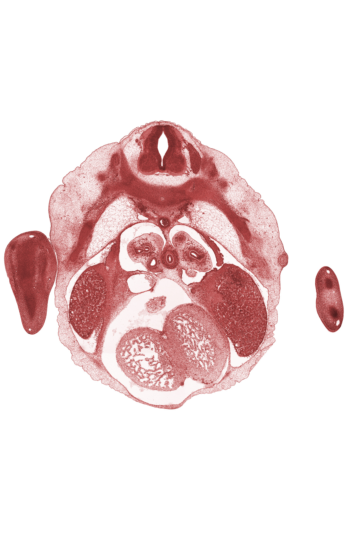 T-5 spinal ganglion, central canal, dorsal meso-esophagus, edge of left horn of sinus venosus, epimere, inferior vena cava, interventricular septum, interventricular sulcus, left ventricle, lower secondary bronchus, mammary gland, neural arch, pericardial cavity, pleural cavity, rib 5, right ventricle