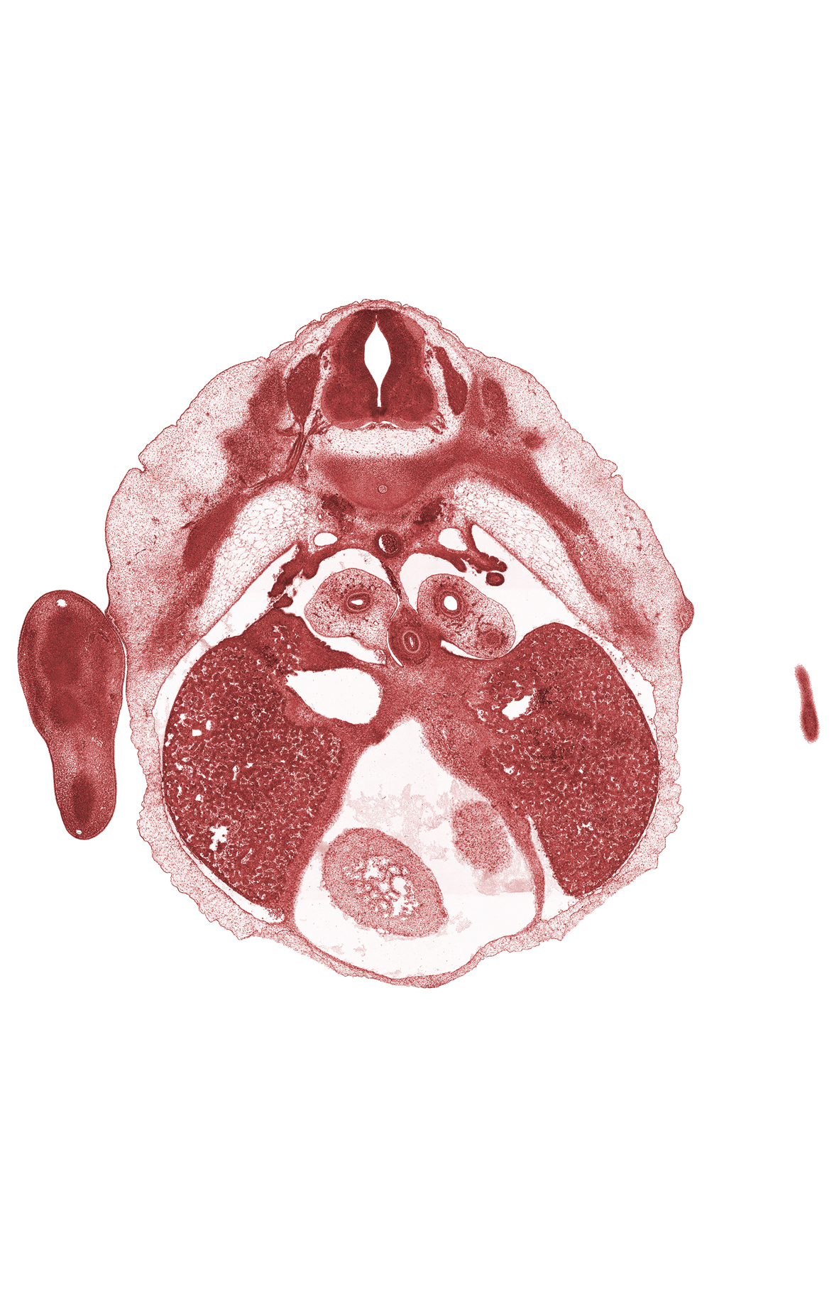 T-5 spinal ganglion, caudal end of upper limb, cephalic edge of mesonephros, edge of left ventricle, epimere, left lobe of liver, mammary gland, neural arch of T-6 vertebra, paramesonephric groove, pericardial cavity, pleuroperitoneal opening, rib 6, right lobe of liver, right ventricle, trabecular part of right ventricle, upper limb