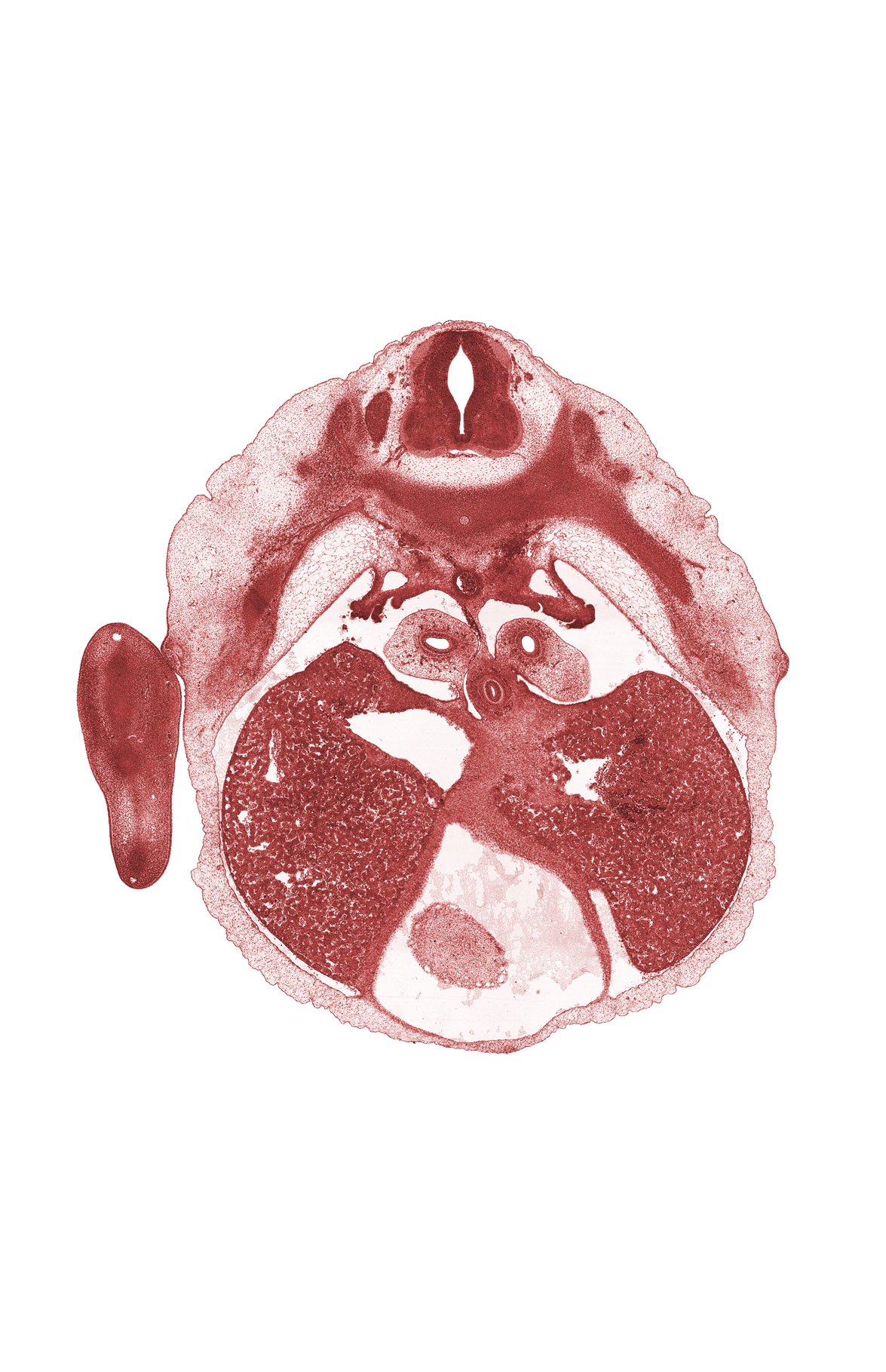 T-5 / T-6 interganglion region, central canal, esophagus, left lobe of liver, lower secondary bronchus, paramesonephric groove, pericardial cavity, peritoneal cavity, pleural cavity, pneumo-enteric recess, postcardinal vein, rib 6, right ventricle, tertiary bronchopulmonary buds in lower lobe of left lung, upper limb