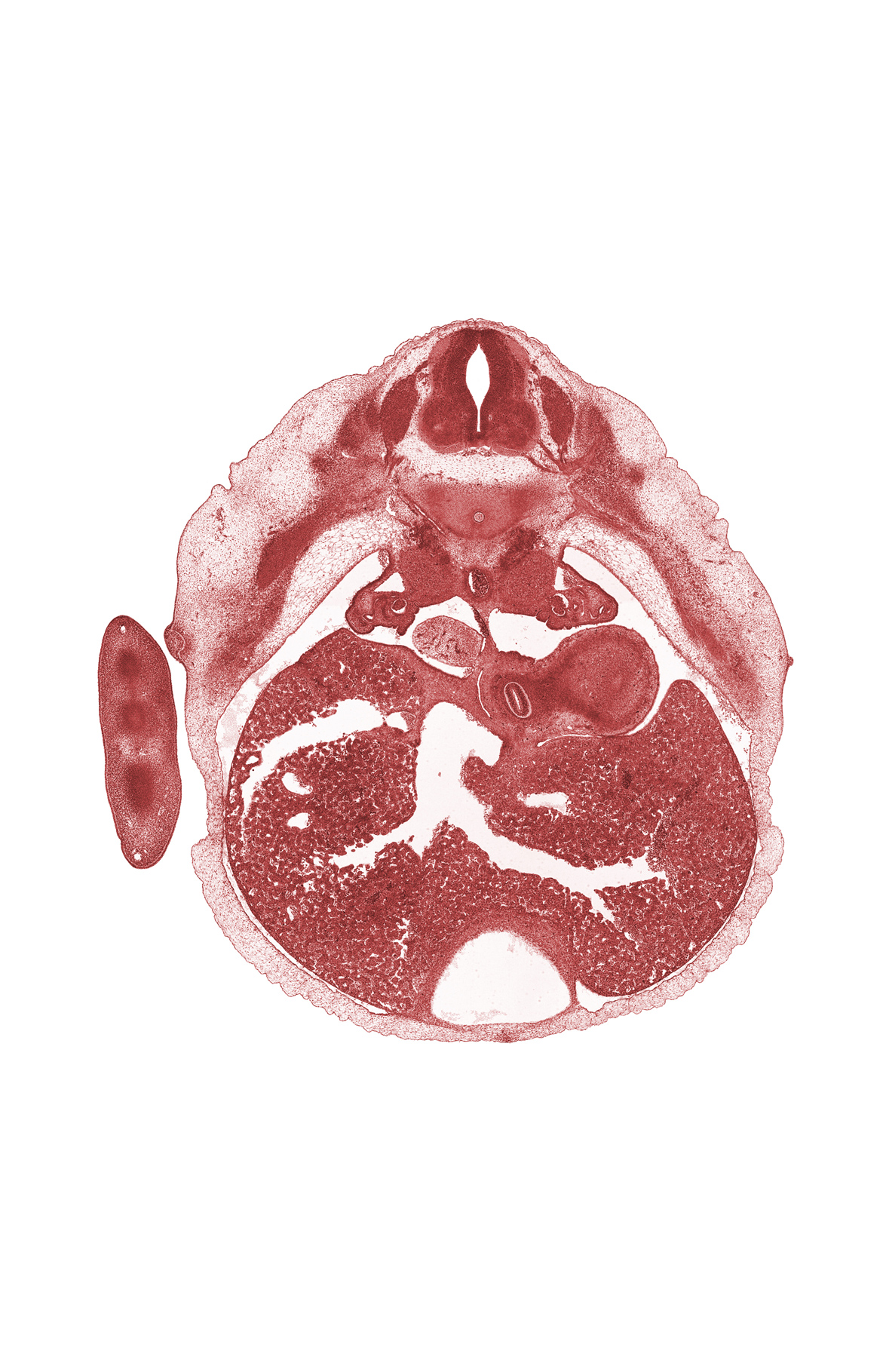 T-6 spinal ganglion, alar plate(s), aorta, basal plate, dorsal meso-esophagus, ductus venosus, efferent hepatic vein, esophagus endoderm, floor plate, mammary gland, medial coelomic bay, pericardial cavity, roof plate, sinusoids of liver, sulcus limitans, suprarenal gland