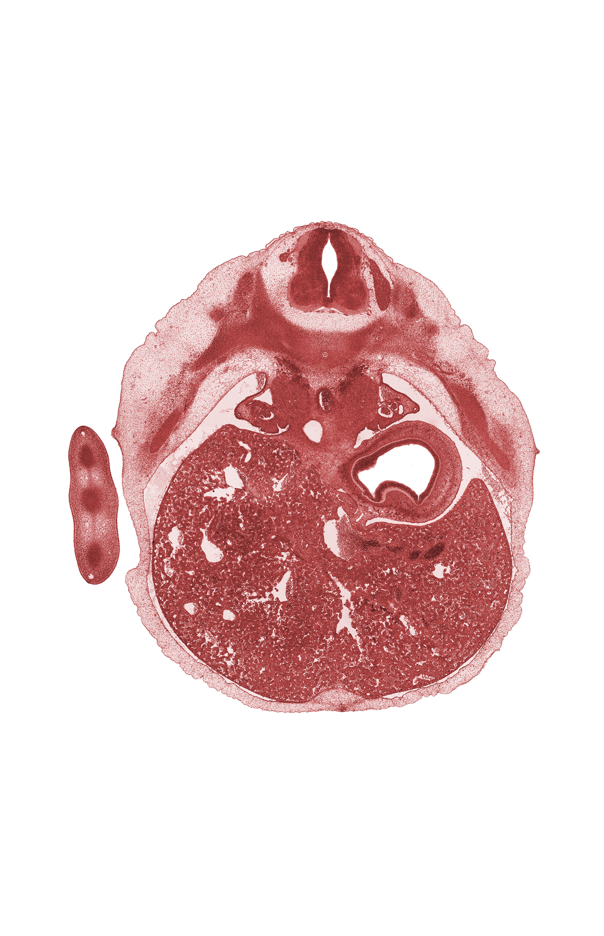 T-7 spinal ganglion, anterior abdominal wall, aorta, circularis muscle layer of stomach, ductus venosus, efferent hepatic vein, left lobe of liver, liver prominence, medial coelomic bay, suprarenal gland