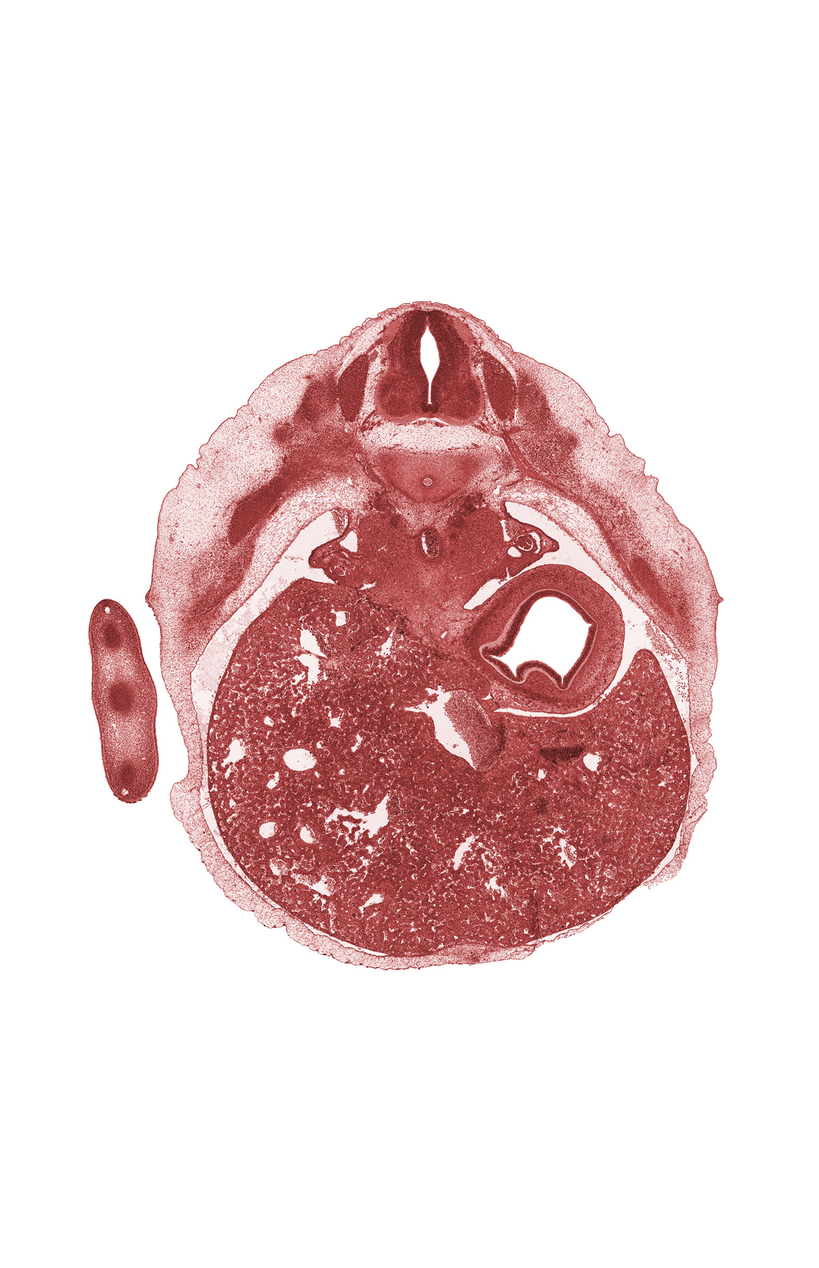 T-7 intercostal nerve, T-7 spinal ganglion, T-7 spinal nerve, body of stomach, hand ray (metacarpal), hepatic sinusoid, left lobe of liver, notochord, paramesonephric groove, postcardinal vein, right lobe of liver