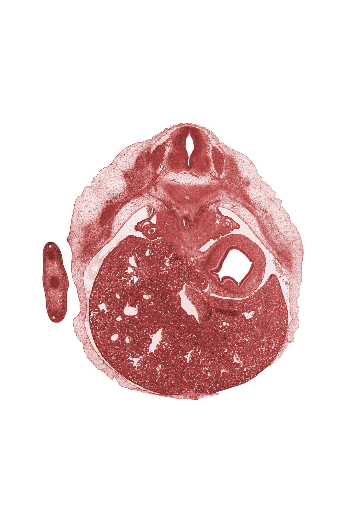 T-7 spinal ganglion, T-7 ventral root, abdominal wall, communicating ramus, ductus venosus, hepatic sinusoid, intercostal muscle(s), meninx, mesonephric duct, mesonephros, missing tissue (artifact), sympathetic trunk