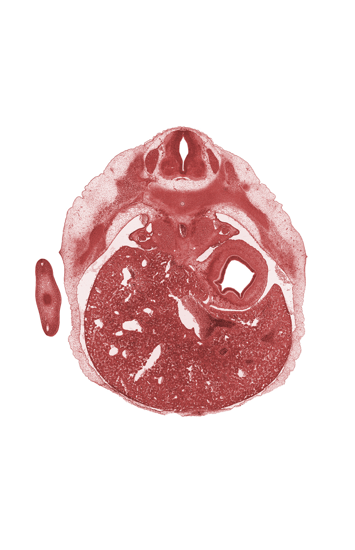 T-7 spinal ganglion, edge of dorsal mesogastrium, intermediate zone, left lobe of liver, liver prominence, lumen of body of stomach, marginal zone, peritoneal cavity, postcardinal vein, rib 8, right lobe of liver, suprarenal gland, ventricular zone