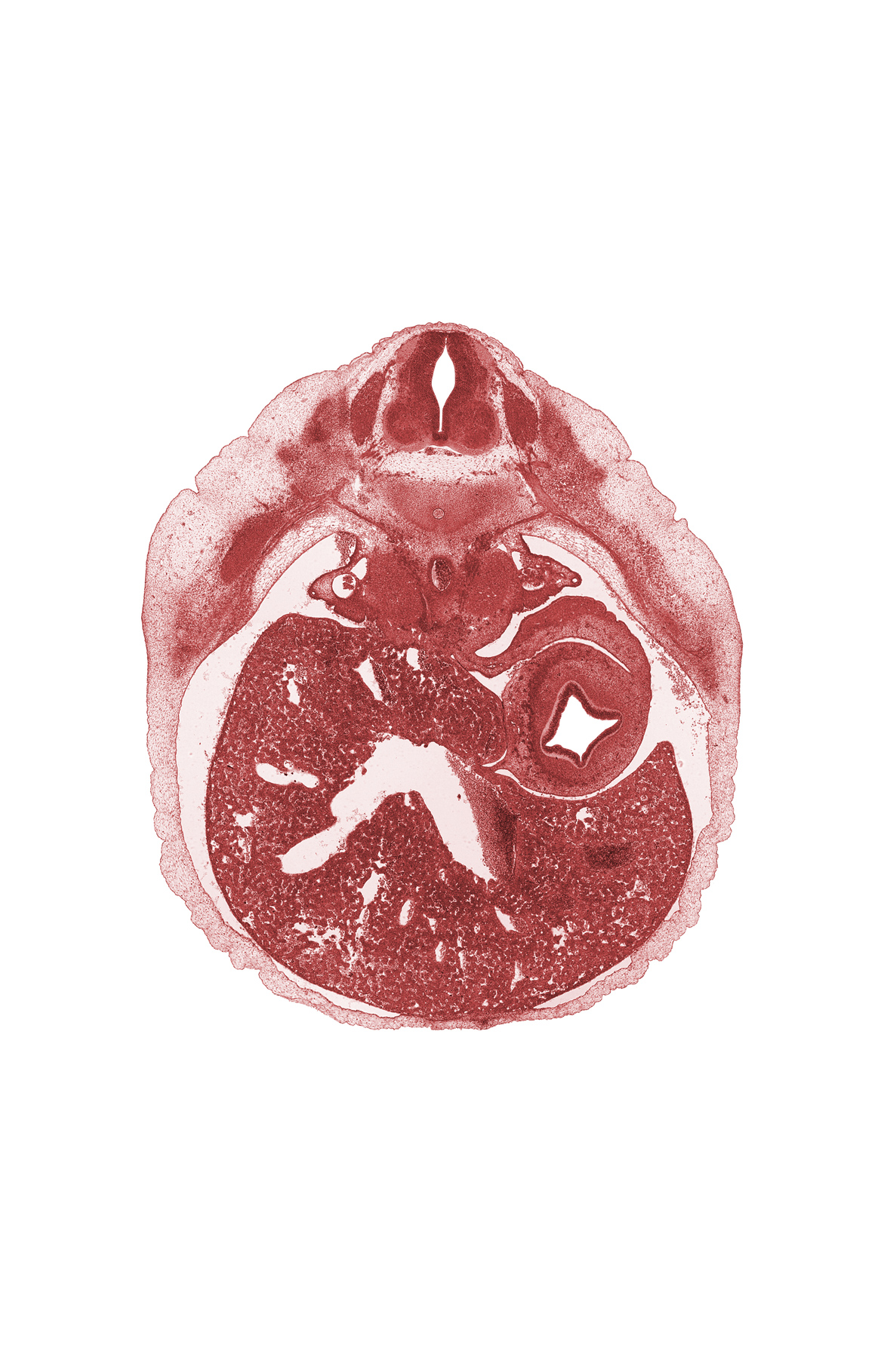 T-8 spinal ganglion, T-8 spinal nerve, afferent hepatic vein, bare area of liver, body of stomach, communicating ramus, greater sac, lesser sac of peritoneal cavity, mesonephric duct, sympathetic trunk