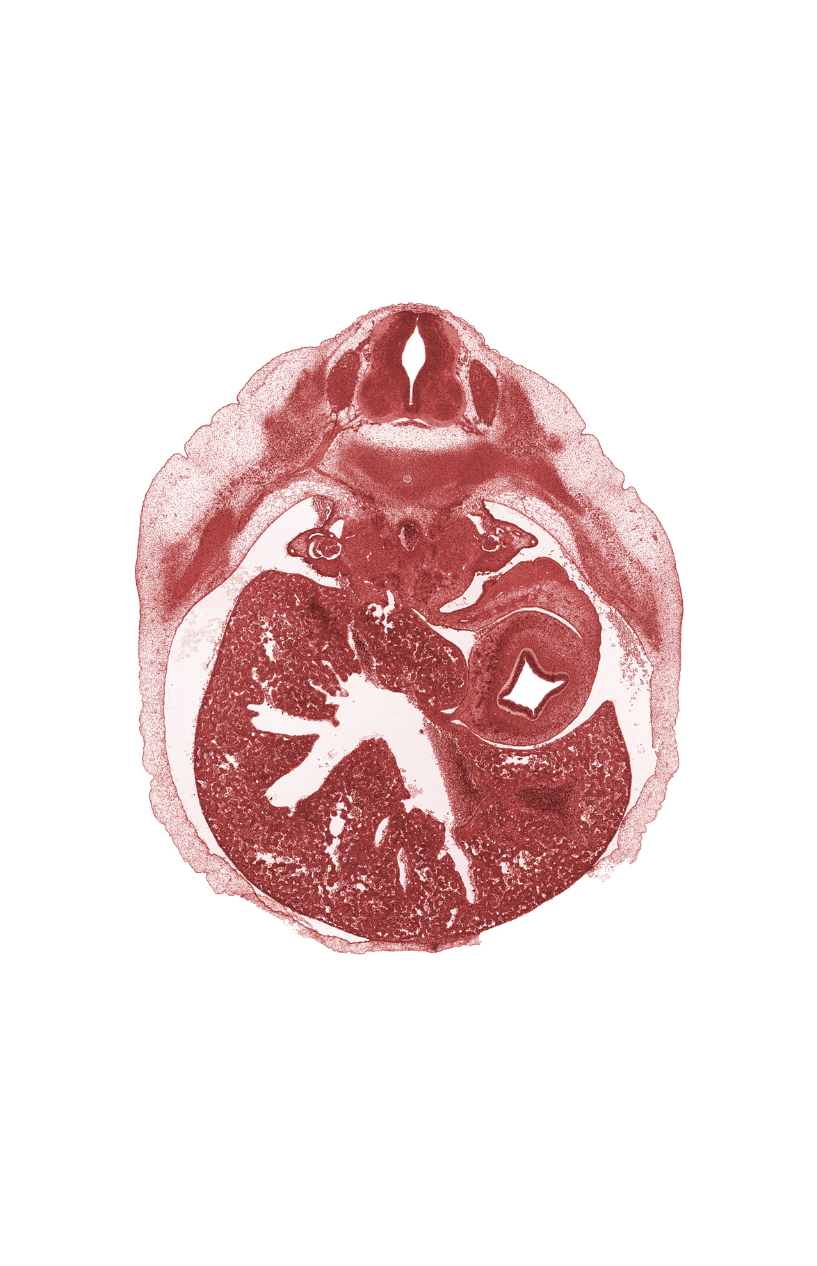 T-8 spinal ganglion, afferent hepatic vein, central canal of spinal cord, dorsal fasciculus, dorsal mesogastrium, ductus venosus, greater curvature of stomach, hepatic sinusoid, lesser curvature of stomach, missing tissue (artifact), rib 9, spleen