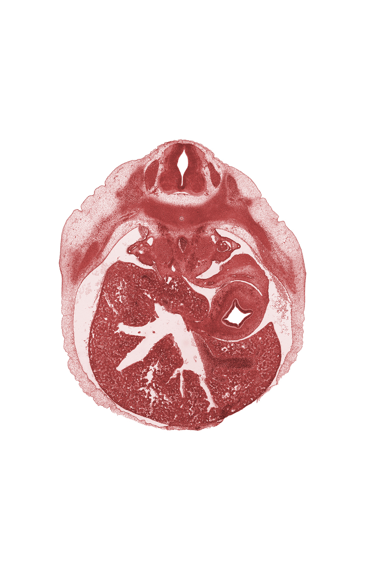 T-8 spinal ganglion, afferent hepatic vein, aorta, ductus venosus, greater sac, junction of mesonephric duct and tubule, left lobe of liver, lesser sac (omental bursa), lumen of body of stomach, rib 9, right lobe of liver, spleen