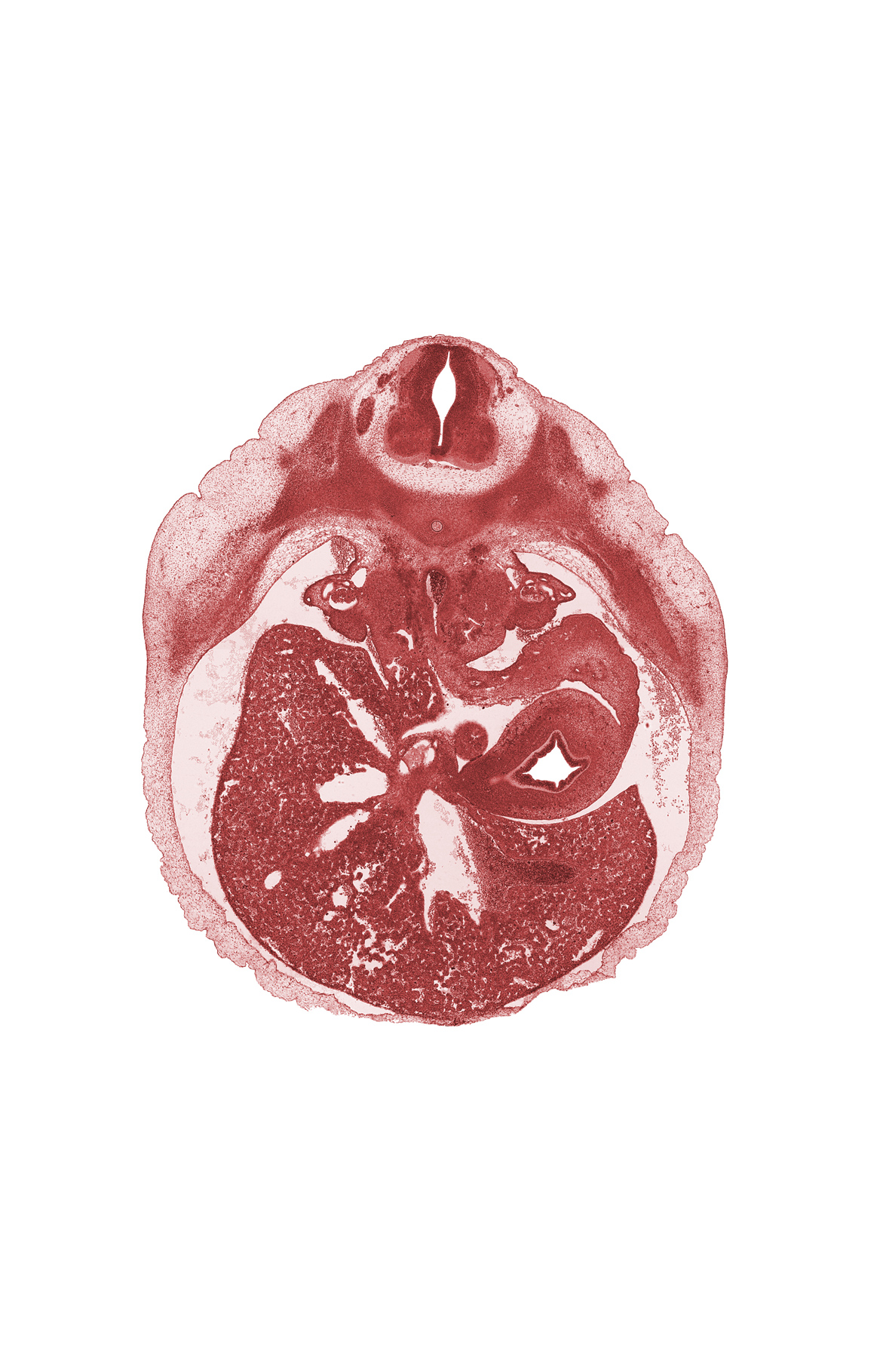 T-8 / T-9 interganglion region, anterior abdominal wall, aorta, celiac artery, ductus venosus, epiploic foramen, hepatic artery, hepatic duct(s), hepatic portal vein, hilum of spleen, left lobe of liver, lesser sac of peritoneal cavity, paramesonephric groove, peritoneal cavity, rib 9, right lobe of liver