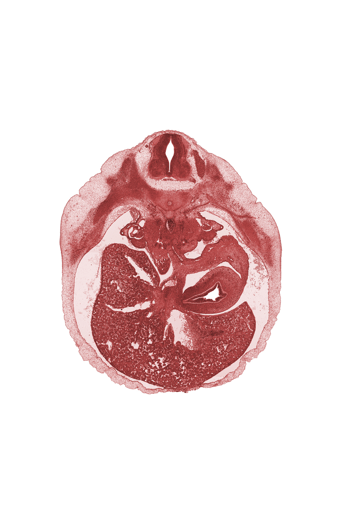 T-9 intercostal nerve, T-9 spinal ganglion, body of stomach, celiac artery, celiac plexus, ductus venosus, hepatic artery, hepatic duct(s), hepatic portal vein, lateral cutaneous nerve, liver prominence, peritoneal cavity, splenic artery, surface ectoderm, vascular plexus