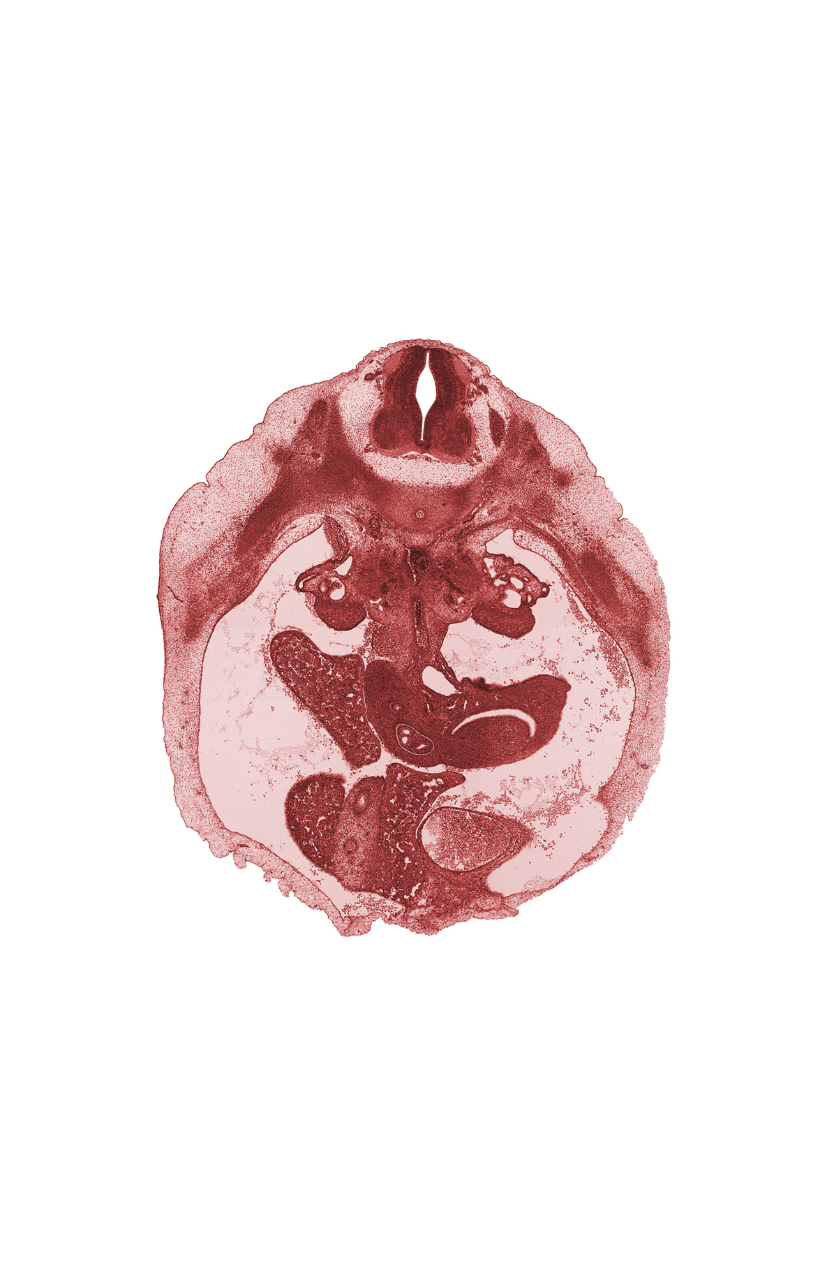 T-10 spinal ganglion, aorta, bile duct, central canal of spinal cord, cystic duct, dorsal pancreas, duct of ventral pancreas, duodenum, gall bladder, gonadal ridge, junction of duct of dorsal pancreas and duodenum, peritoneal cavity, superior mesenteric artery, superior mesenteric vein