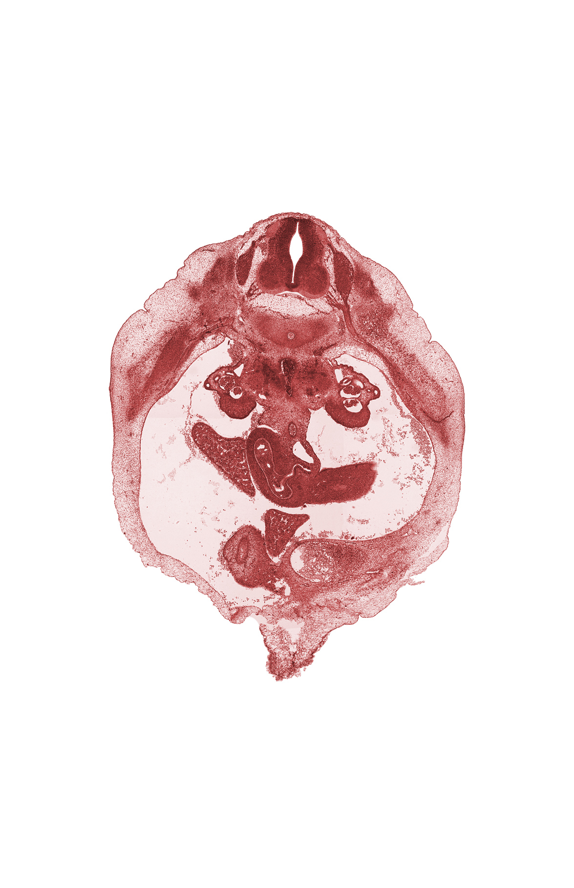 T-10 spinal ganglion, T-10 spinal nerve, bile duct, cephalic edge of umbilical cord, duodenum, gall bladder, mesonephric capsule, mesonephric glomerulus, mesonephric tubule(s), paramesonephric groove, peritoneal cavity, right lobe of liver, superior mesenteric artery, superior mesenteric vein, umbilical vein, ventral pancreas