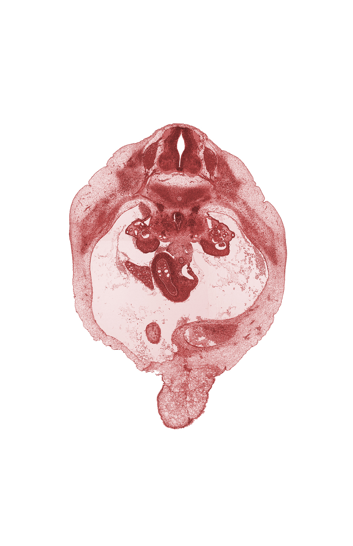 T-10 spinal ganglion, aorta, duodenum, edge of gall bladder, intermediate zone, junction of bile duct and duodenum, marginal zone, mesonephric duct, paramesonephric groove, peritoneal cavity, right lobe of liver, superior mesenteric artery, superior mesenteric vein, umbilical vein, ventricular zone