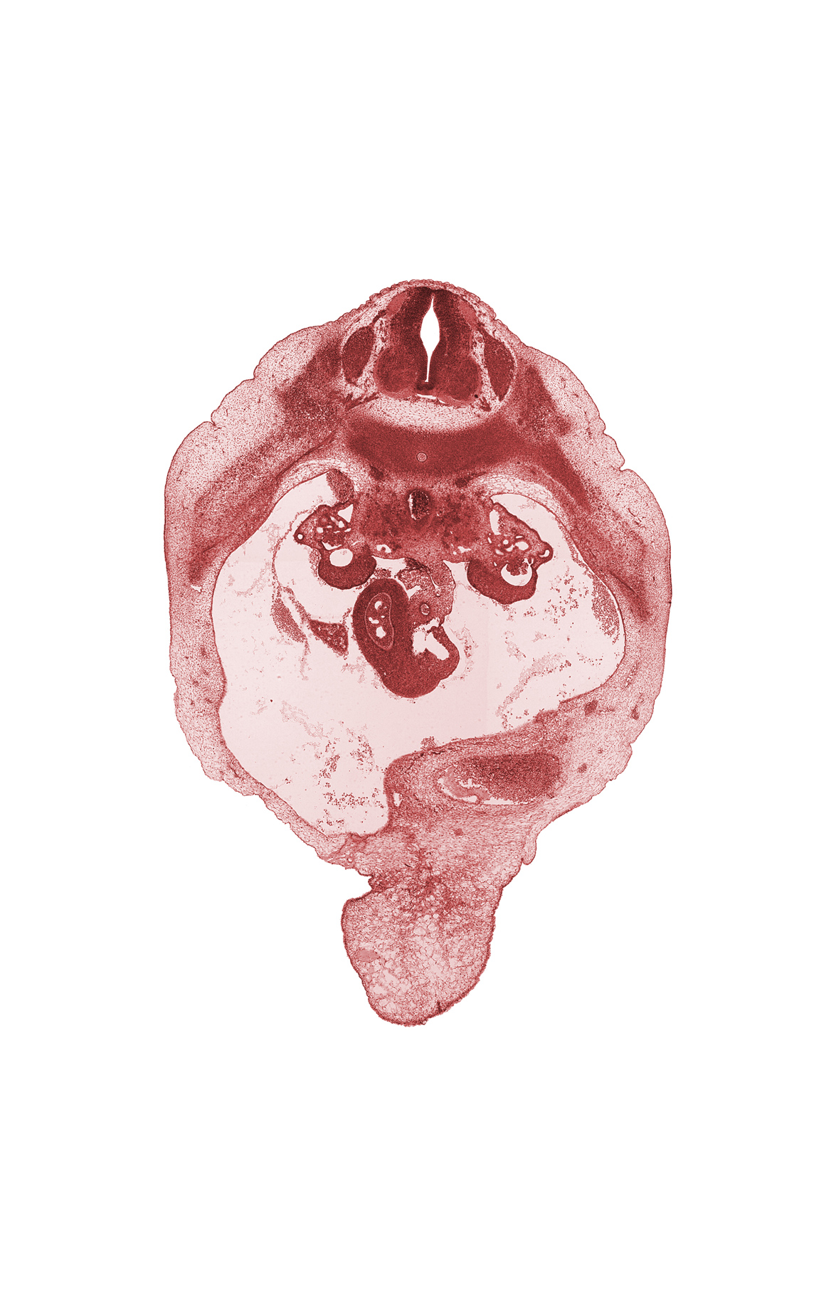 T-10 spinal ganglion, aorta, caudal edge of right lobe of liver, central canal, duodenum (second part), gonadal ridge, junction of bile duct and ventral pancreatic duct, neural arch, peritoneal cavity, rib 11, superior mesenteric artery, superior mesenteric vein, umbilical cord, umbilical vein