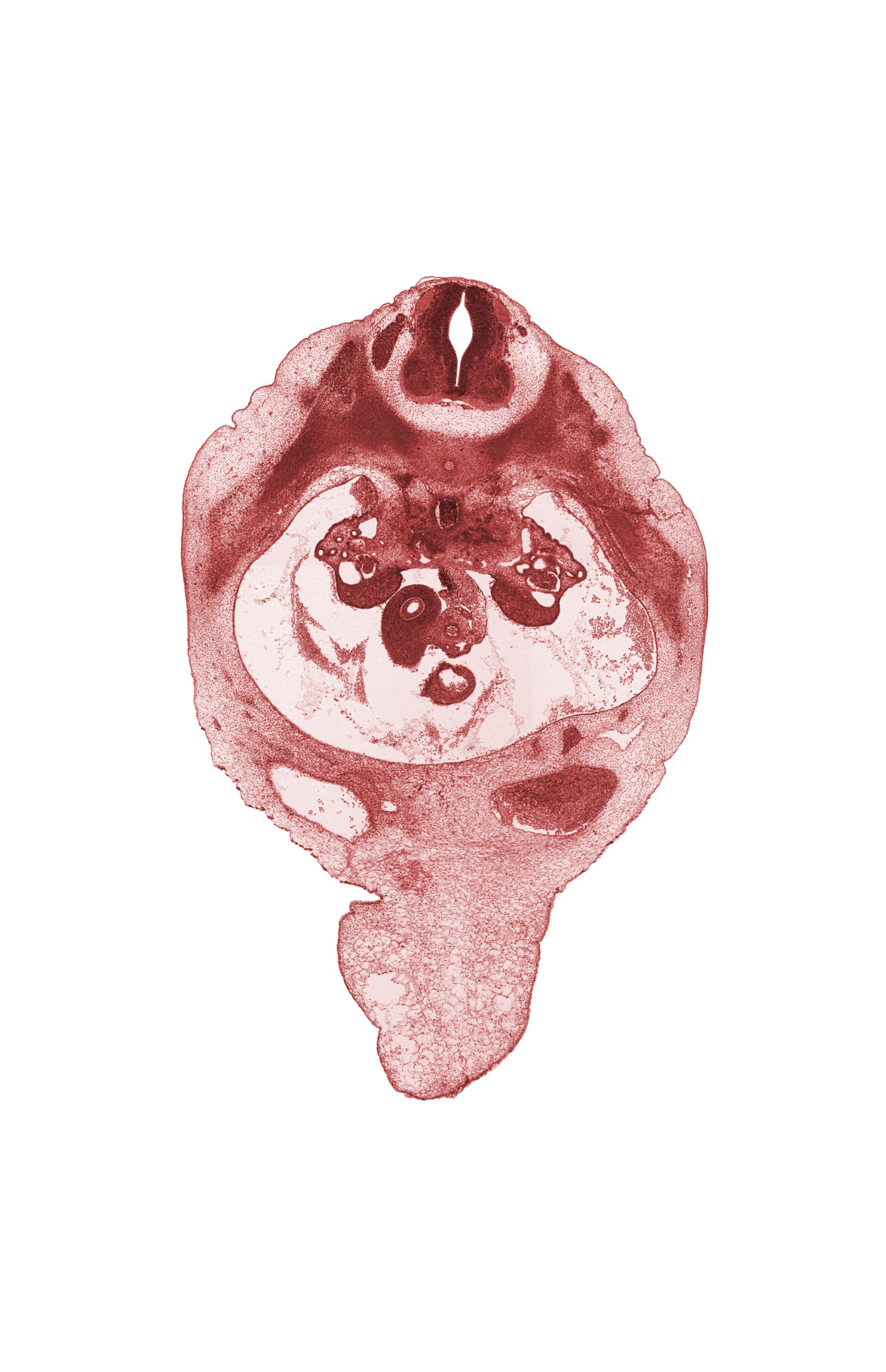 T-10 / T-11 interganglion region, aorta, duodenum, epimere, glomerulus, gonadal ridge, hypomere, mesonephric duct, mucoid connective tissue, nerve plexus, notochord, peritoneal cavity, superior mesenteric artery, superior mesenteric vein, sympathetic trunk, umbilical cord