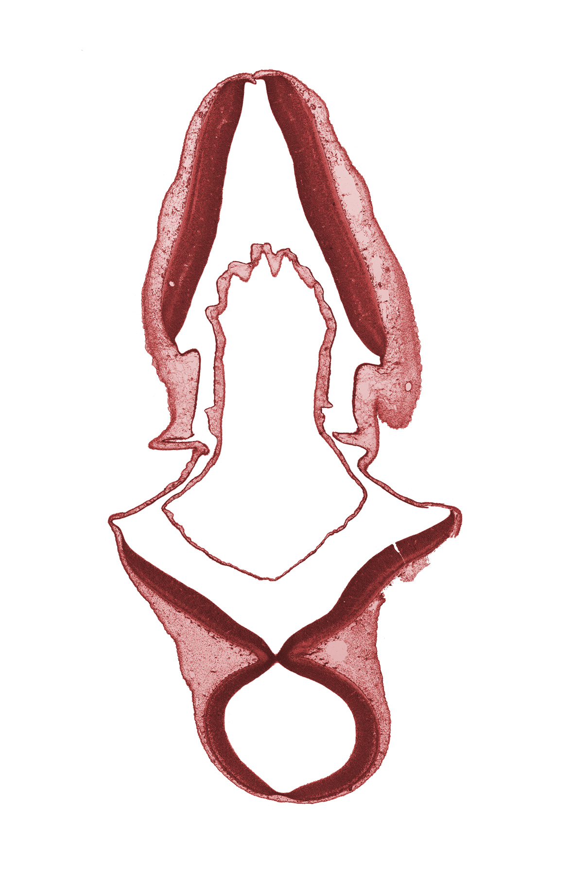 edge of endolymphatic duct, head mesenchyme, mesencephalon (M2), metencephalon, myelencephalon, root of trochlear nerve (CN IV)