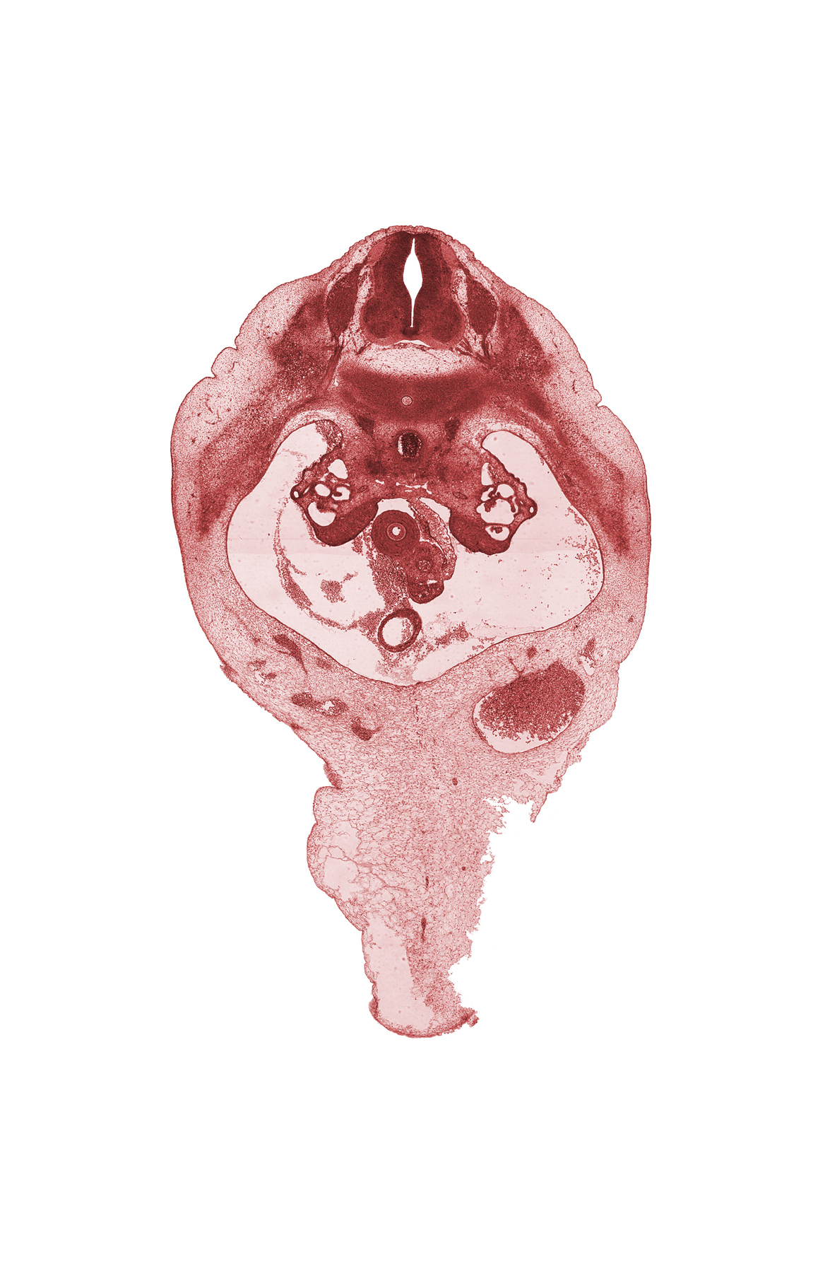 T-11 spinal ganglion, amnion on surface of umbilical cord, aorta, duodenum, involuting right umbilical vein, missing tissue (artifact), notochord, rib 12, superior mesenteric artery, superior mesenteric vein, surface ectoderm